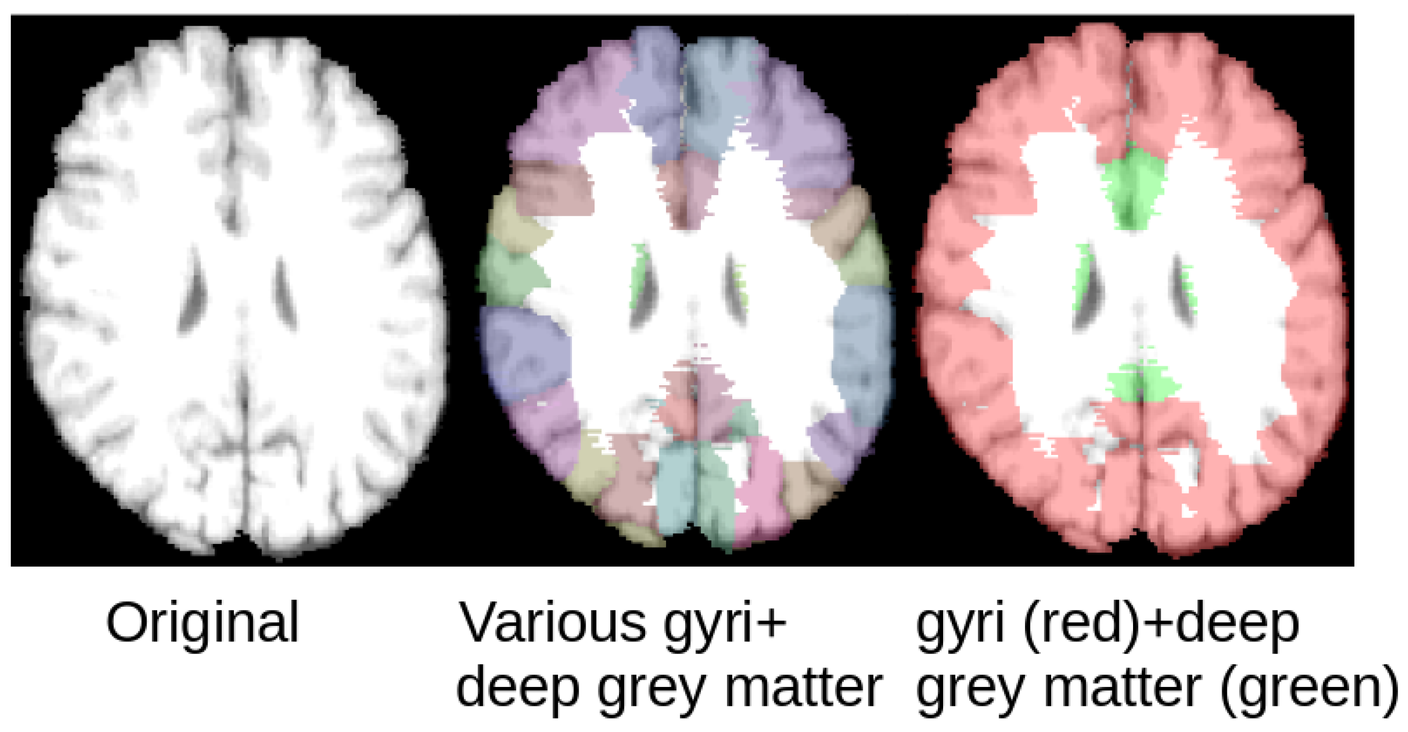 Sensors 21 03874 g004