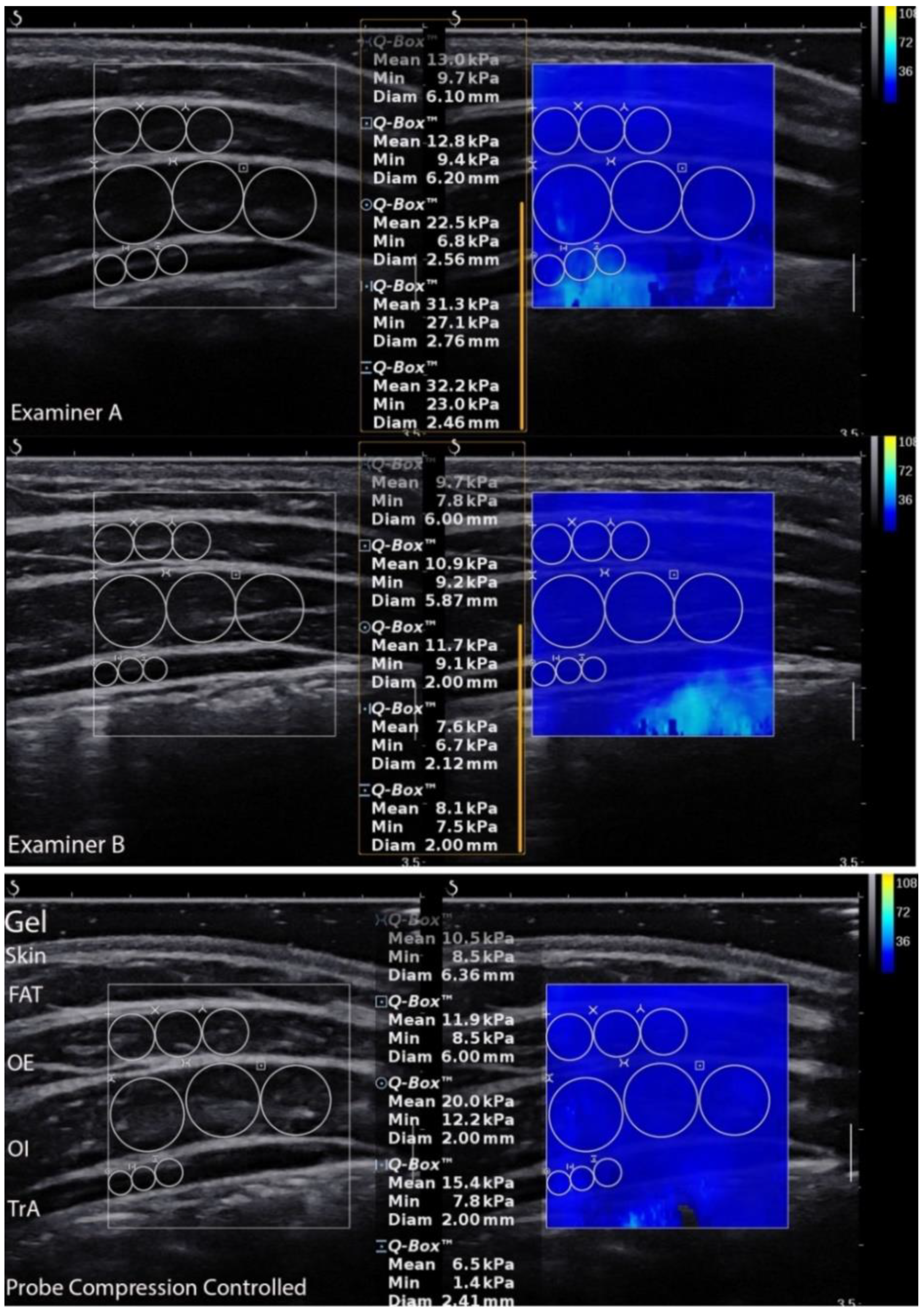 Sensors 21 04036 g002 Sensors 21 04036 g002