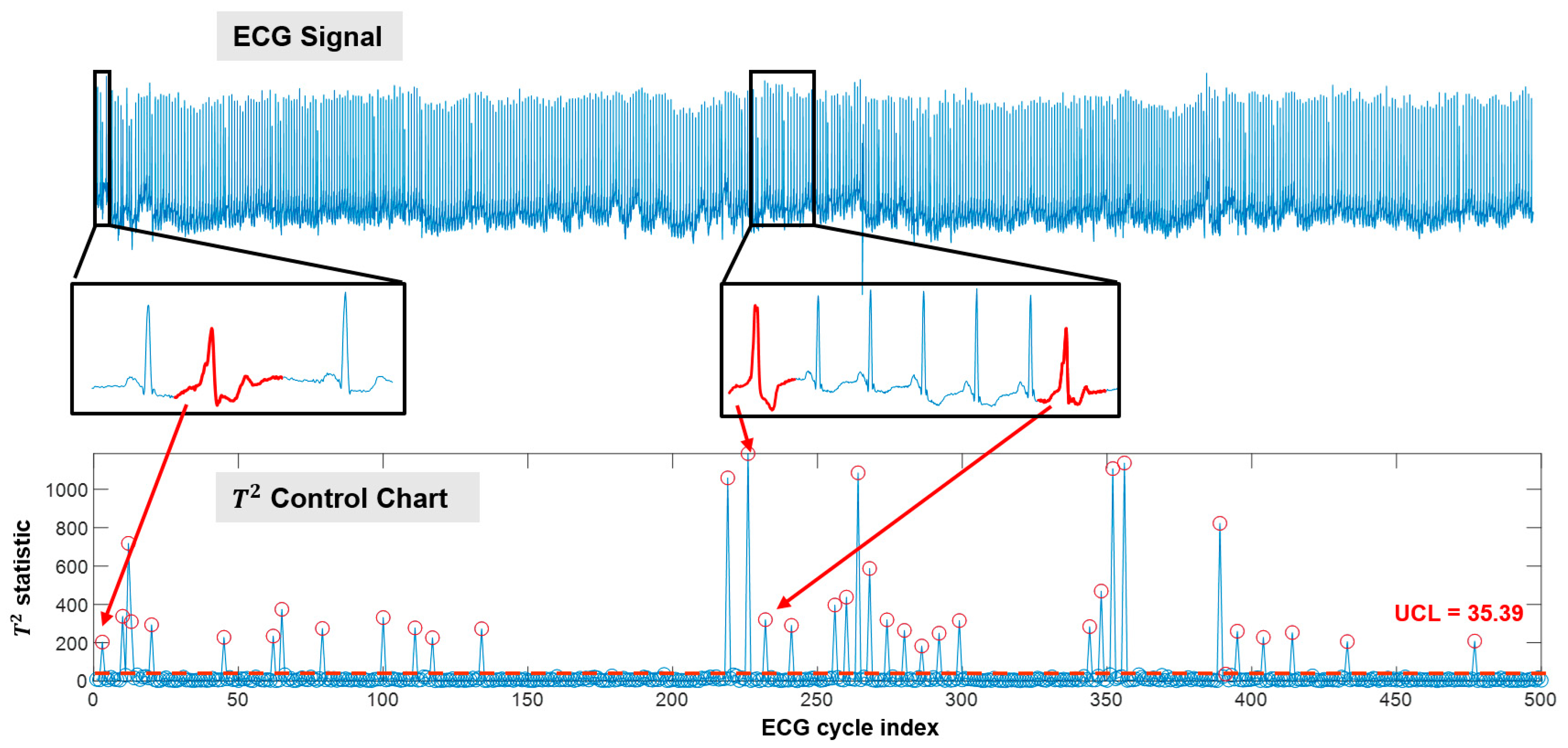 Tensor-Based ECG Anomaly Detection toward Cardiac Monitoring in the ...