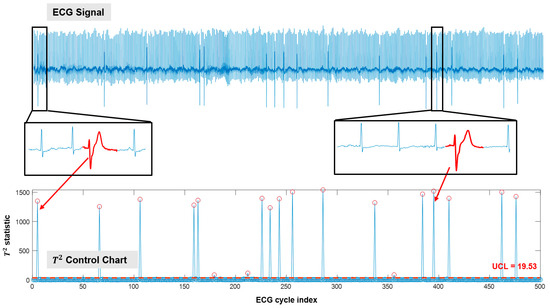 Sensors Free Full Text Tensor Based Ecg Anomaly Detection Toward Cardiac Monitoring In The Internet Of Health Things Html