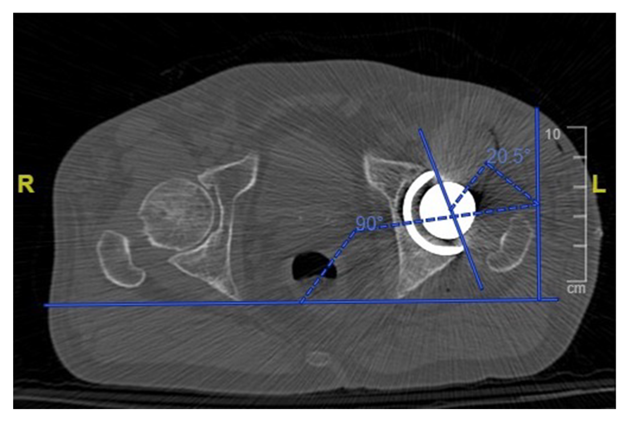 Sensors 21 04232 g006