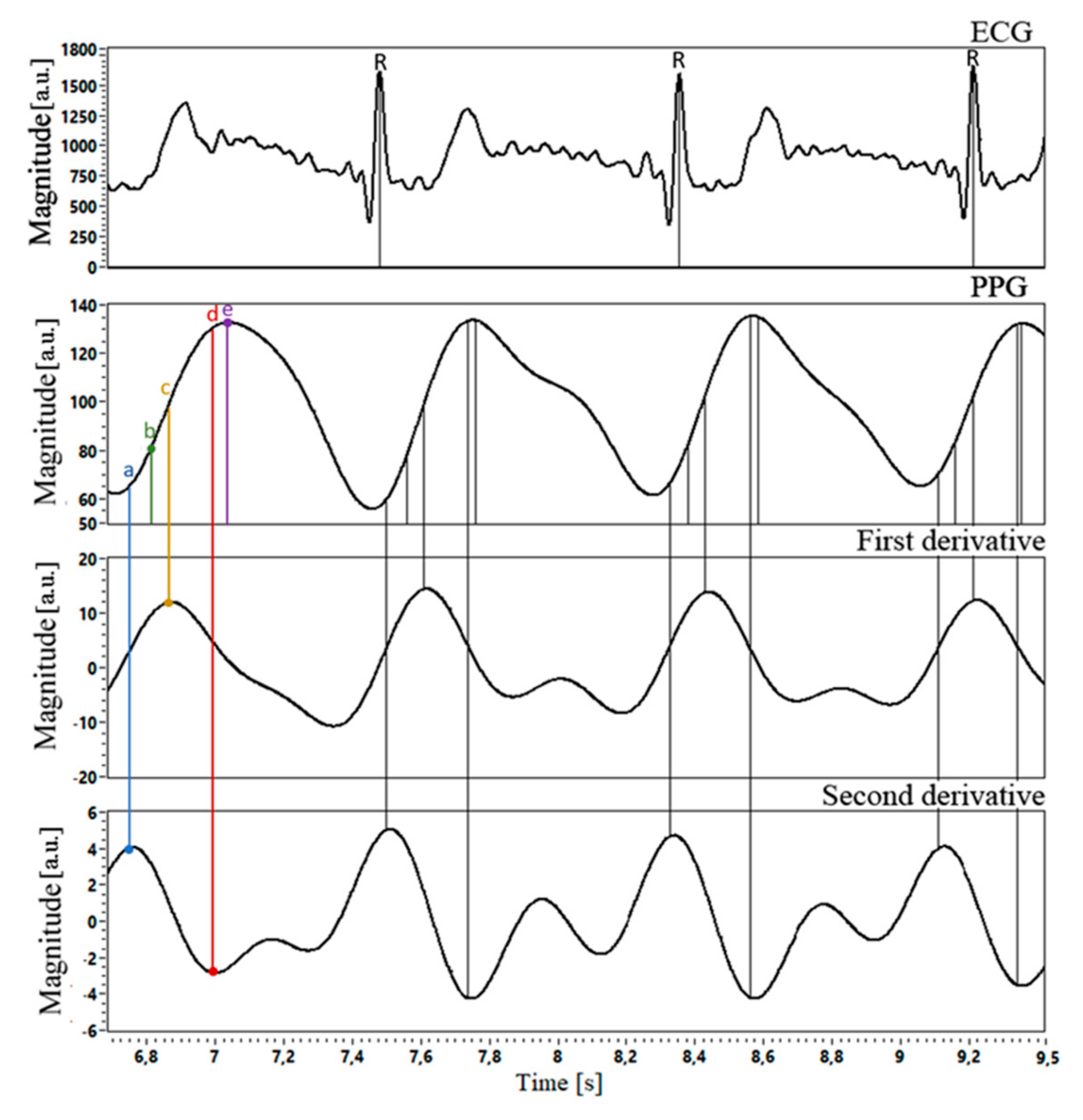 Sensors 21 04241 g005 550