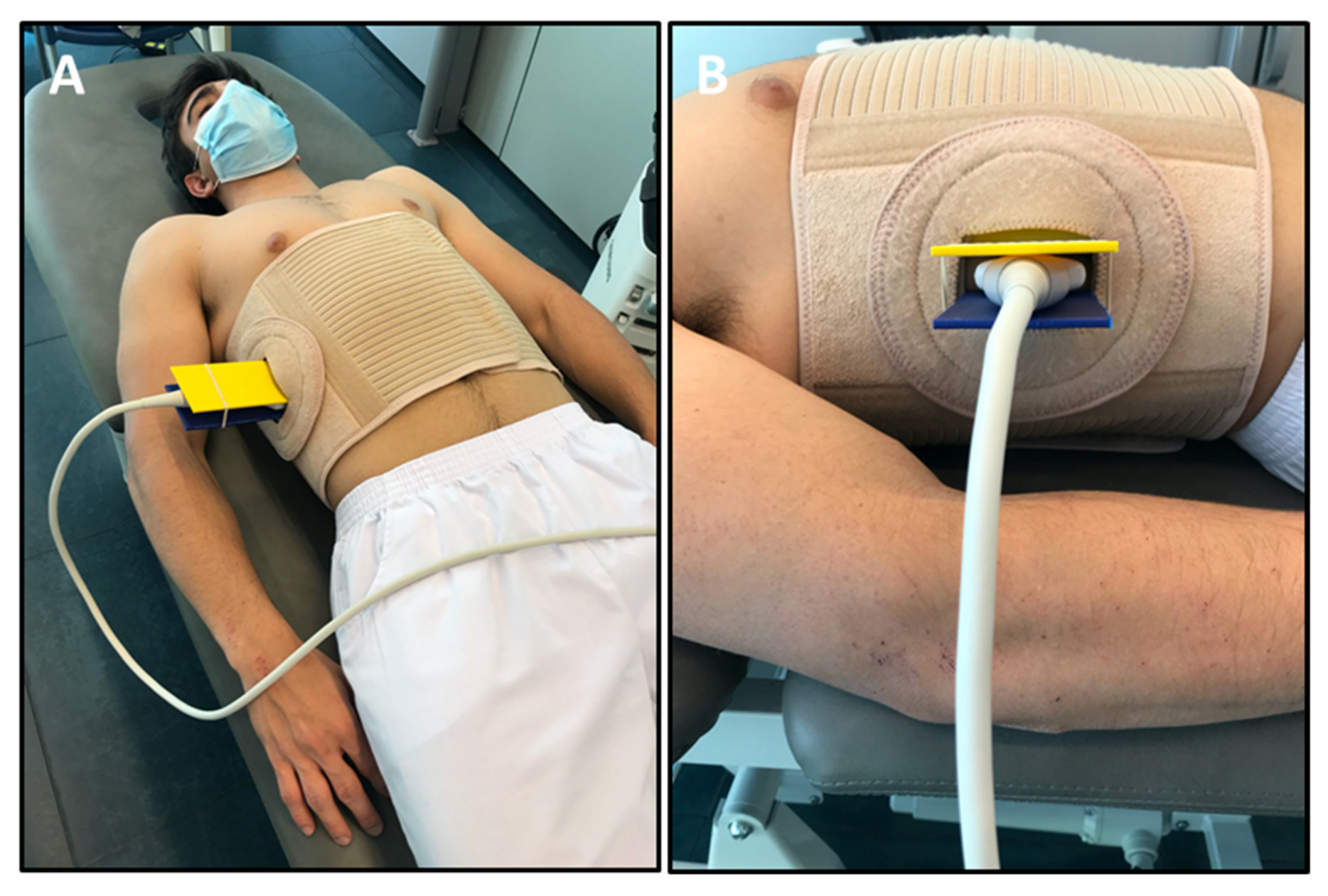 Sensors Free Full-Text Concurrent Validity and Reliability of Manual Versus Specific Device Transcostal Measurements for Breathing Diaphragm Thickness by Ultrasonography in Lumbopelvic Pain Athletes