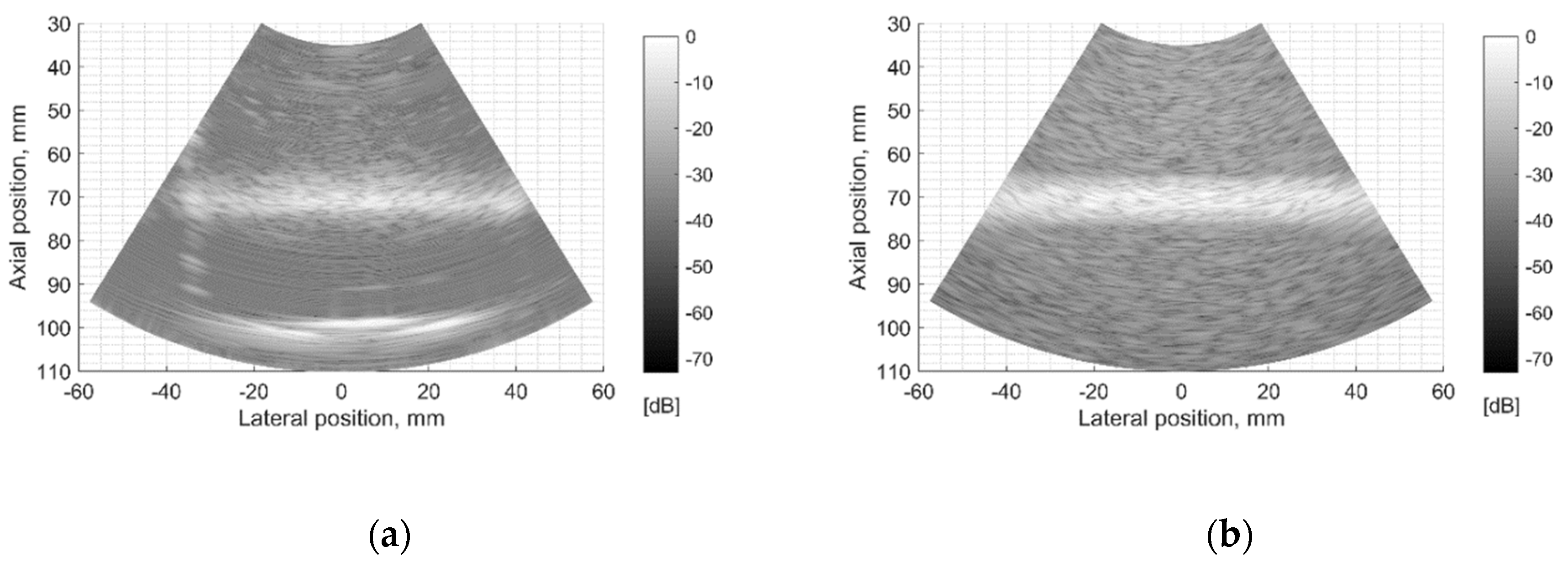 ultrasound simulation software free download ultrasound simulation software free download