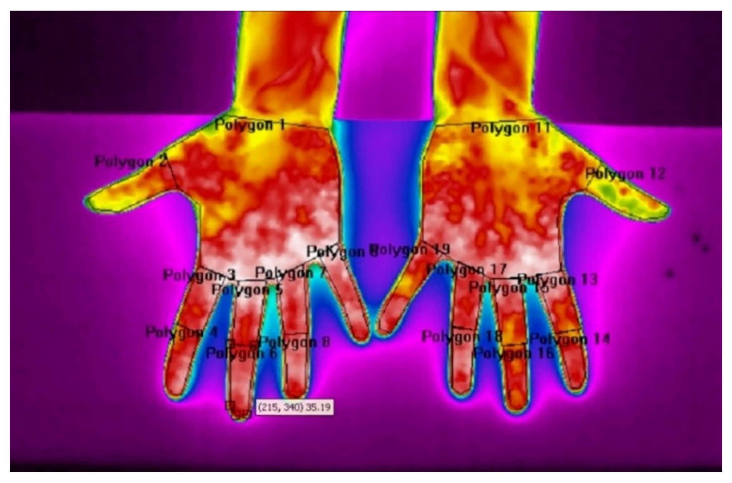 Sensors 21 04497 g003 550