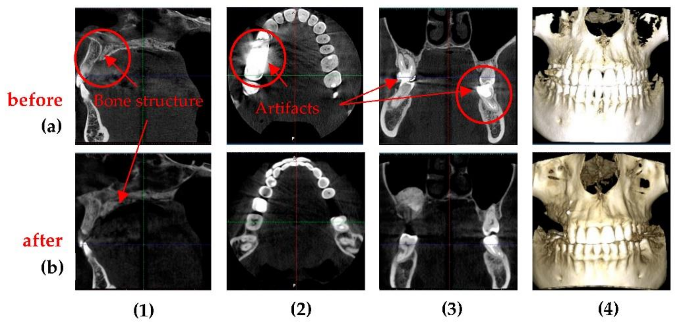 Sensors Free Full Text Optimization Of X Ray Investigations In Dentistry Using Optical Coherence Tomography Html