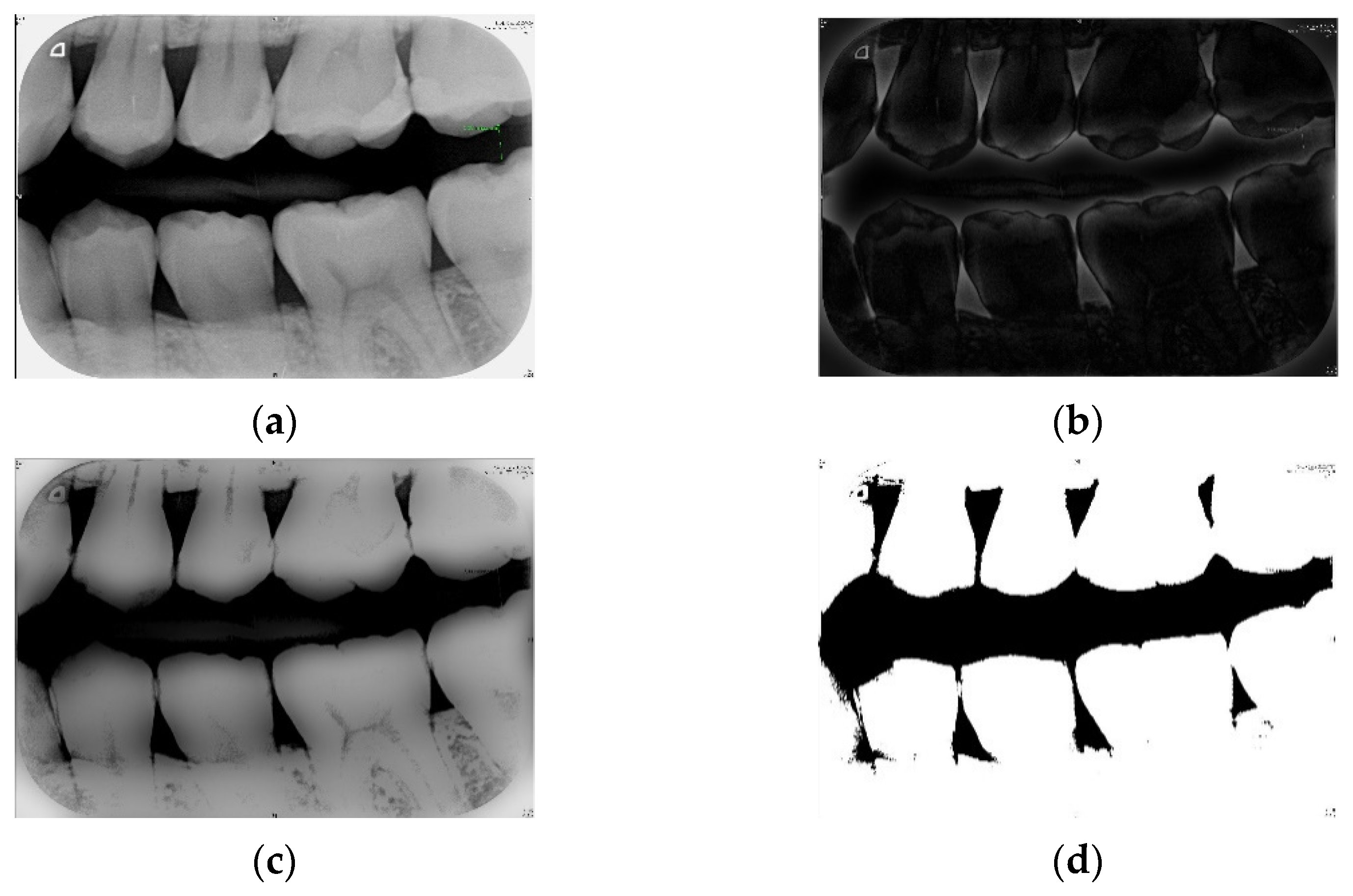 Sensors Free FullText Caries and Restoration Detection Using