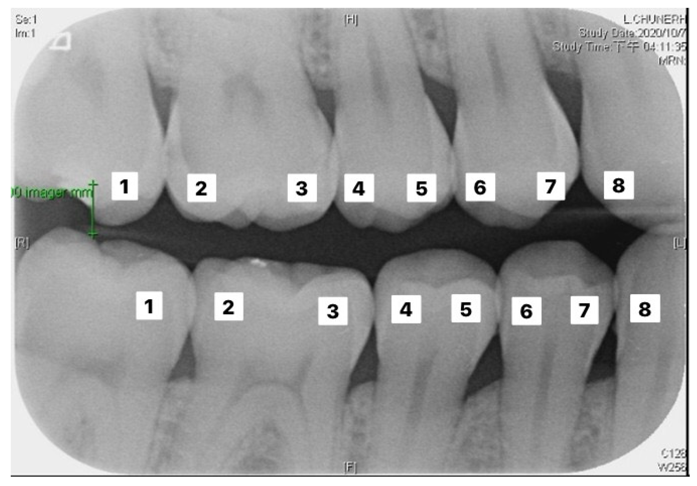 Sensors 21 04613 g009 550