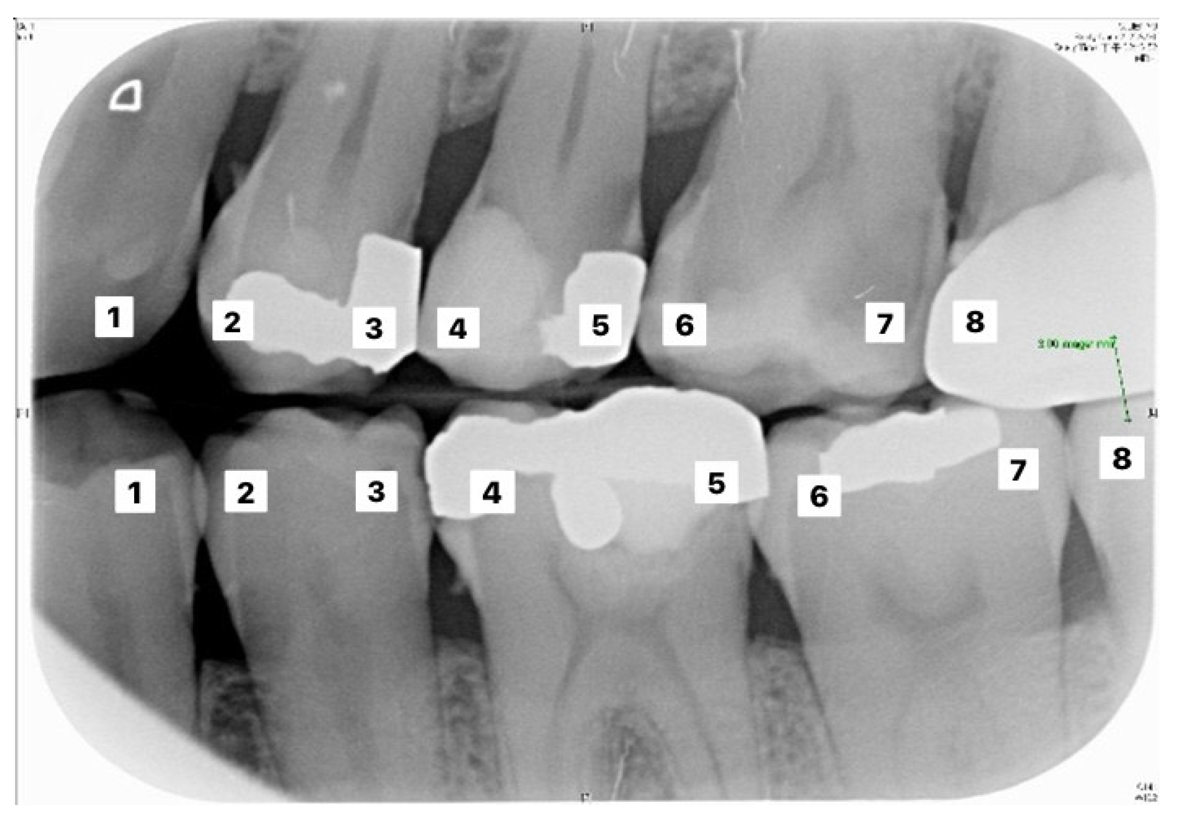 Sensors 21 04613 g010 550