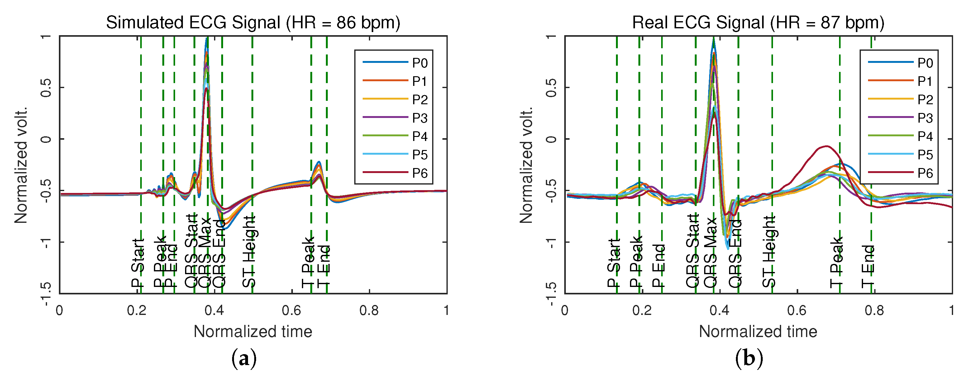 Sensors 21 04822 g004