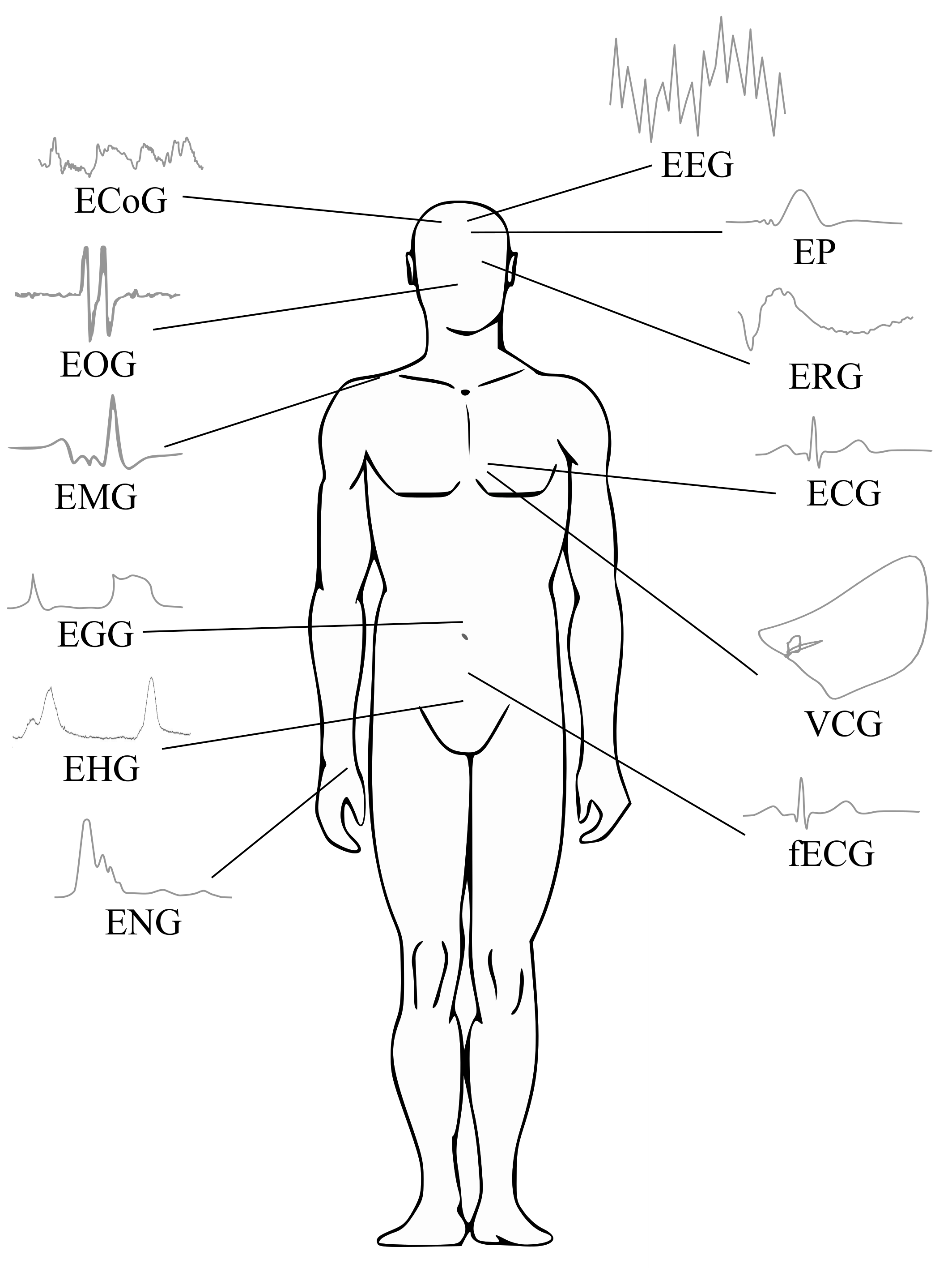 Sensors Free FullText Advanced Bioelectrical Signal Processing