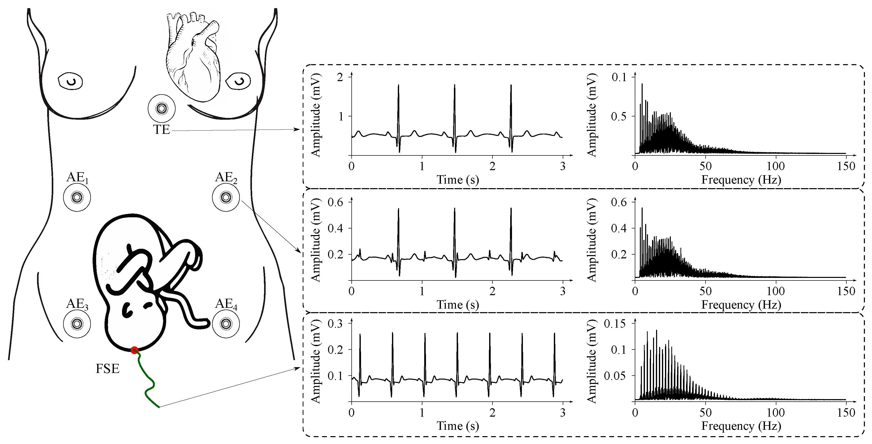 Sensors Free FullText Advanced Bioelectrical Signal Processing