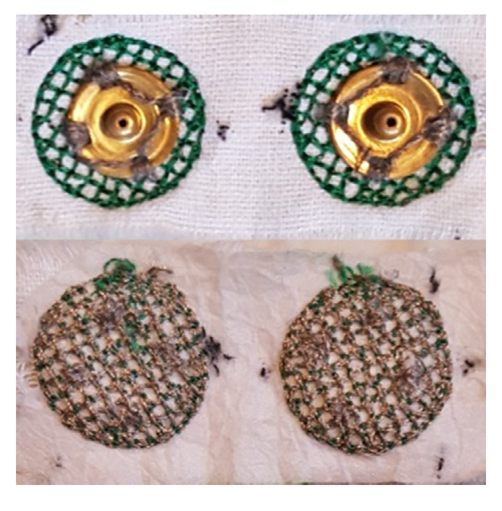 Sensors 21 05245 g001 550