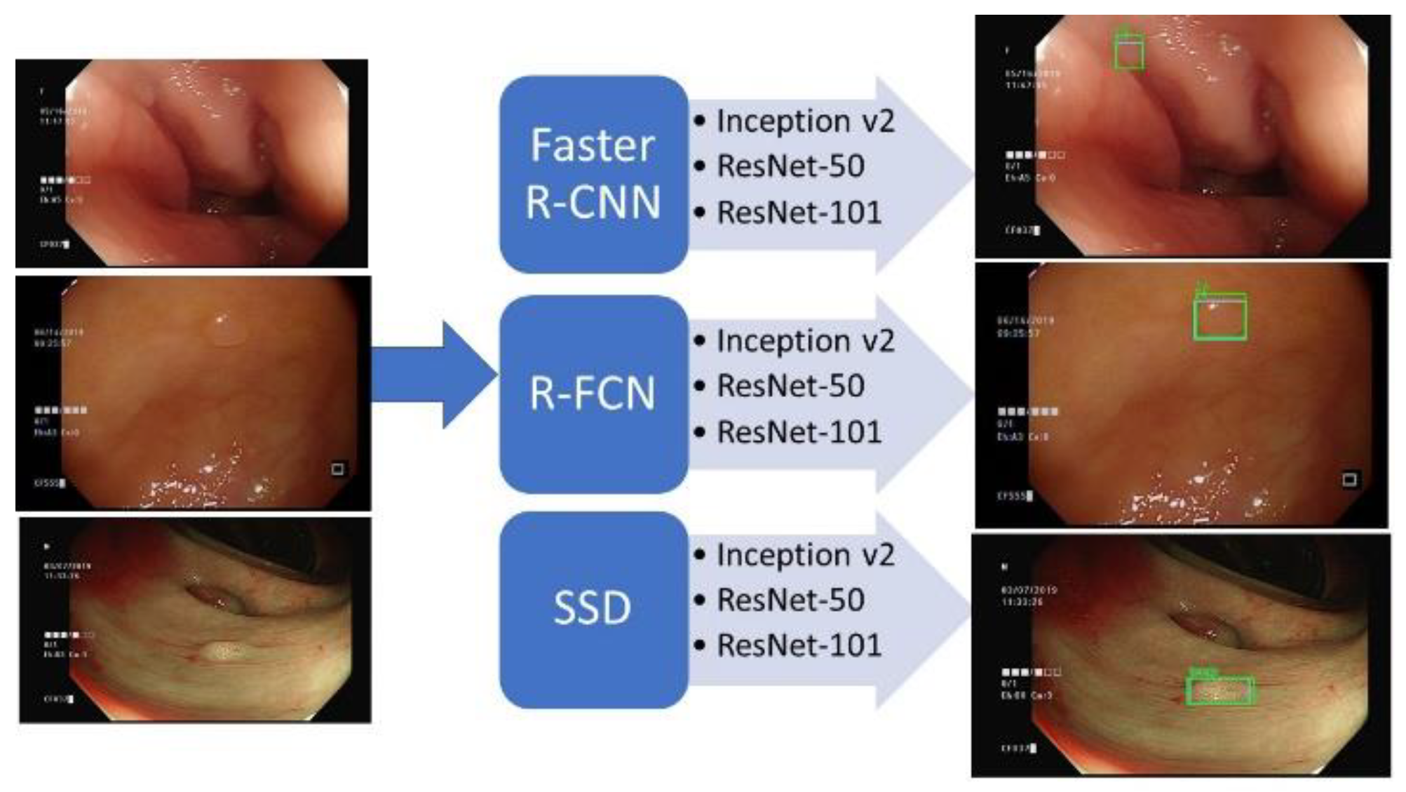 girl main land Personally Sensors | Free Full-Text | Computer-Aided Colon Polyp Detection on High Resolution Colonoscopy Using Transfer Learning Techniques girl main land Personally Sensors | Free Full-Text | Computer-Aided Colon Polyp Detection on High Resolution Colonoscopy Using Transfer Learning Techniques