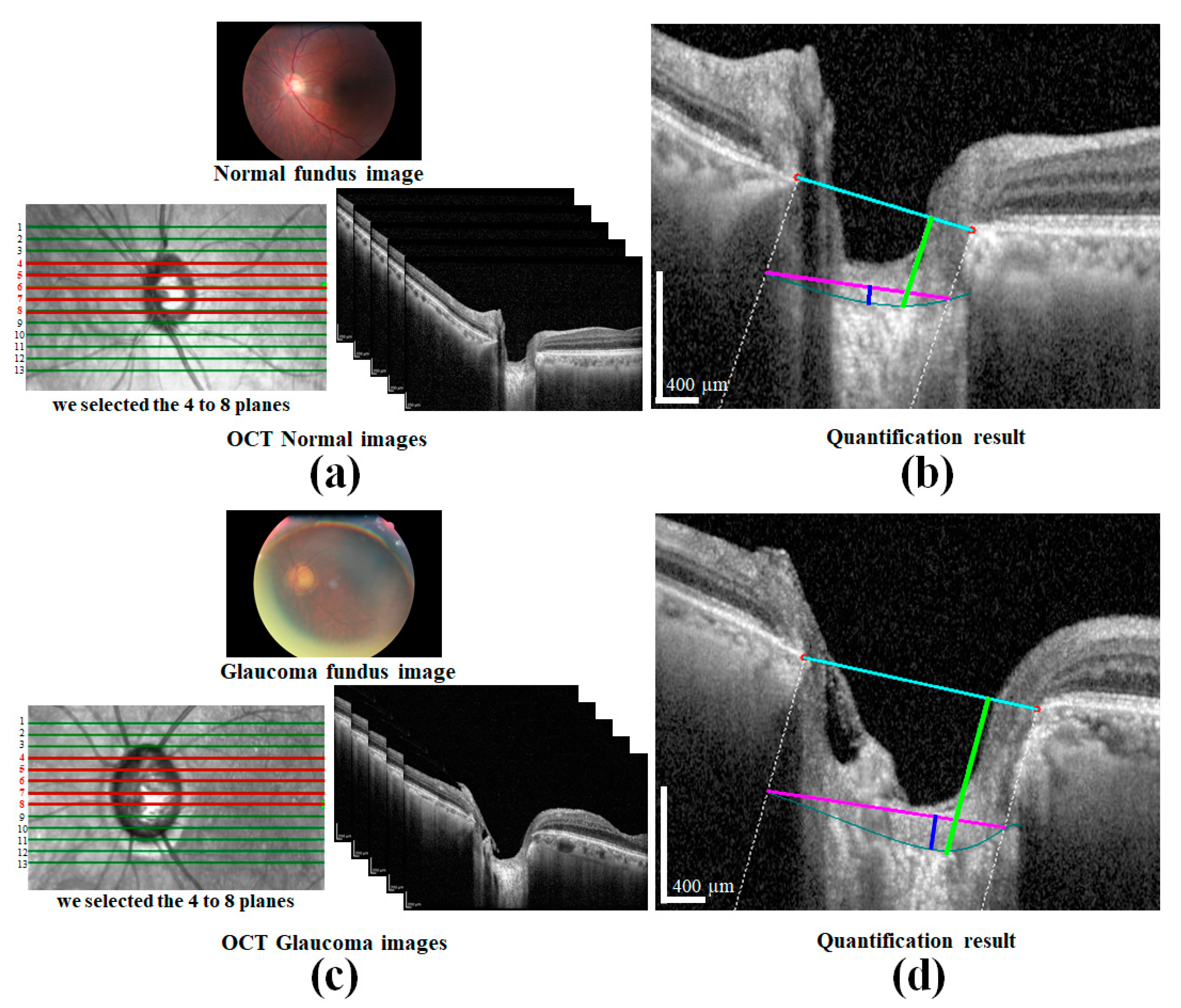 Sensors 21 05383 g013 550