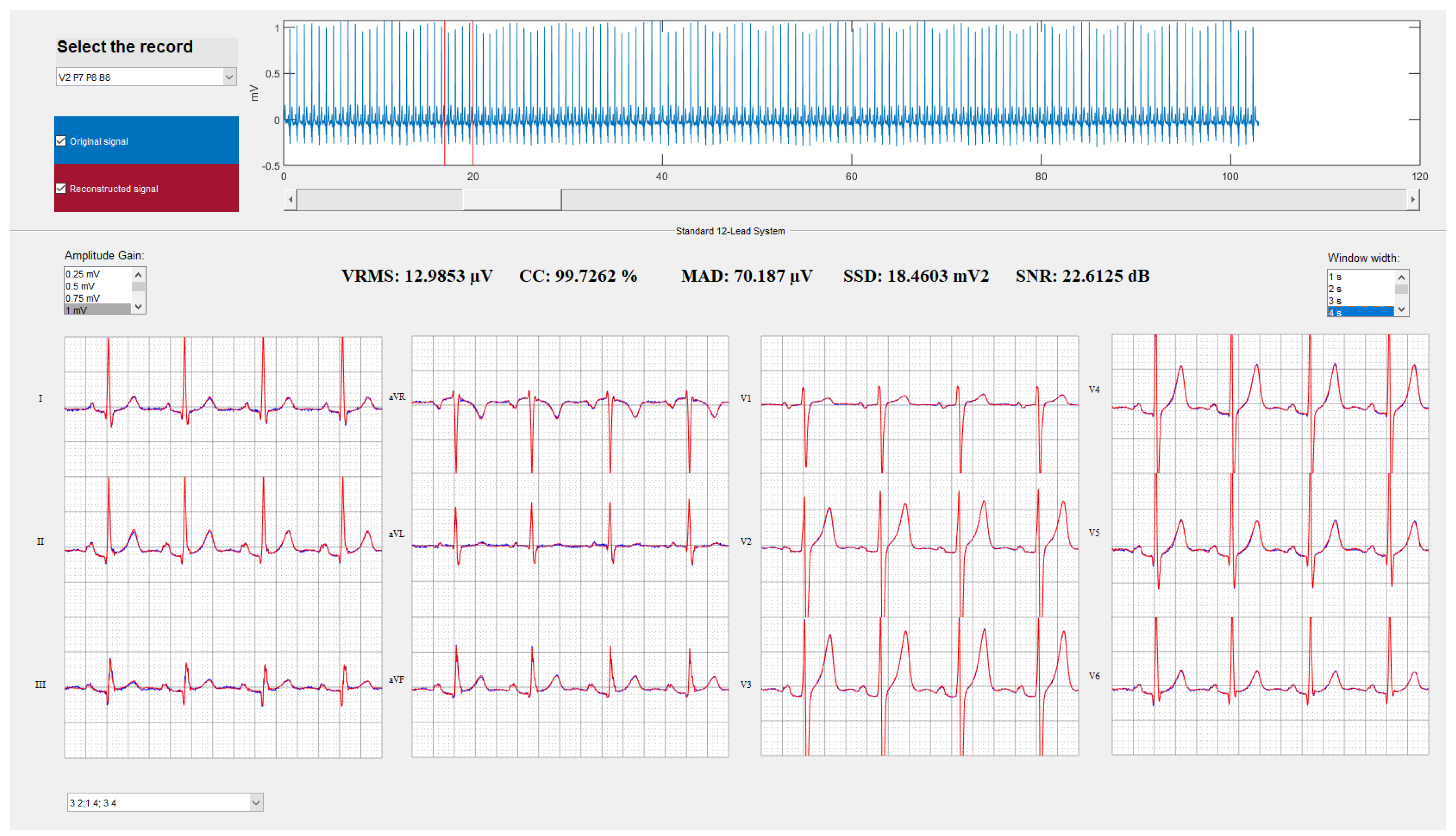 Sensors 21 05542 g009 Sensors 21 05542 g009