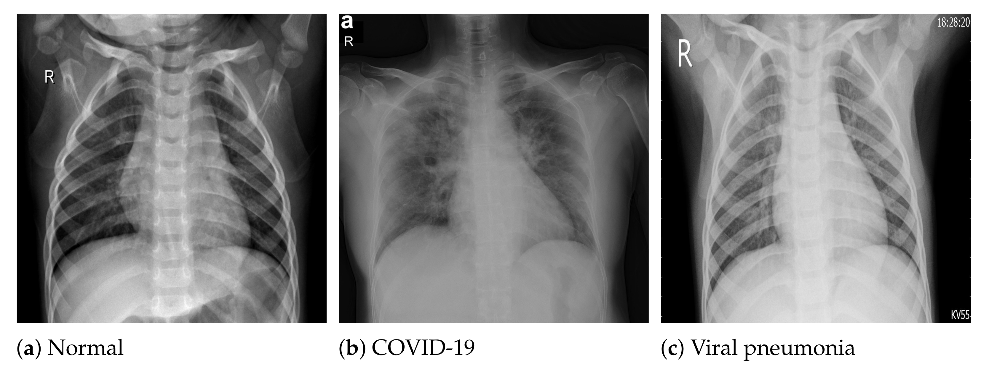 Inverted X-Ray make-up challenge 