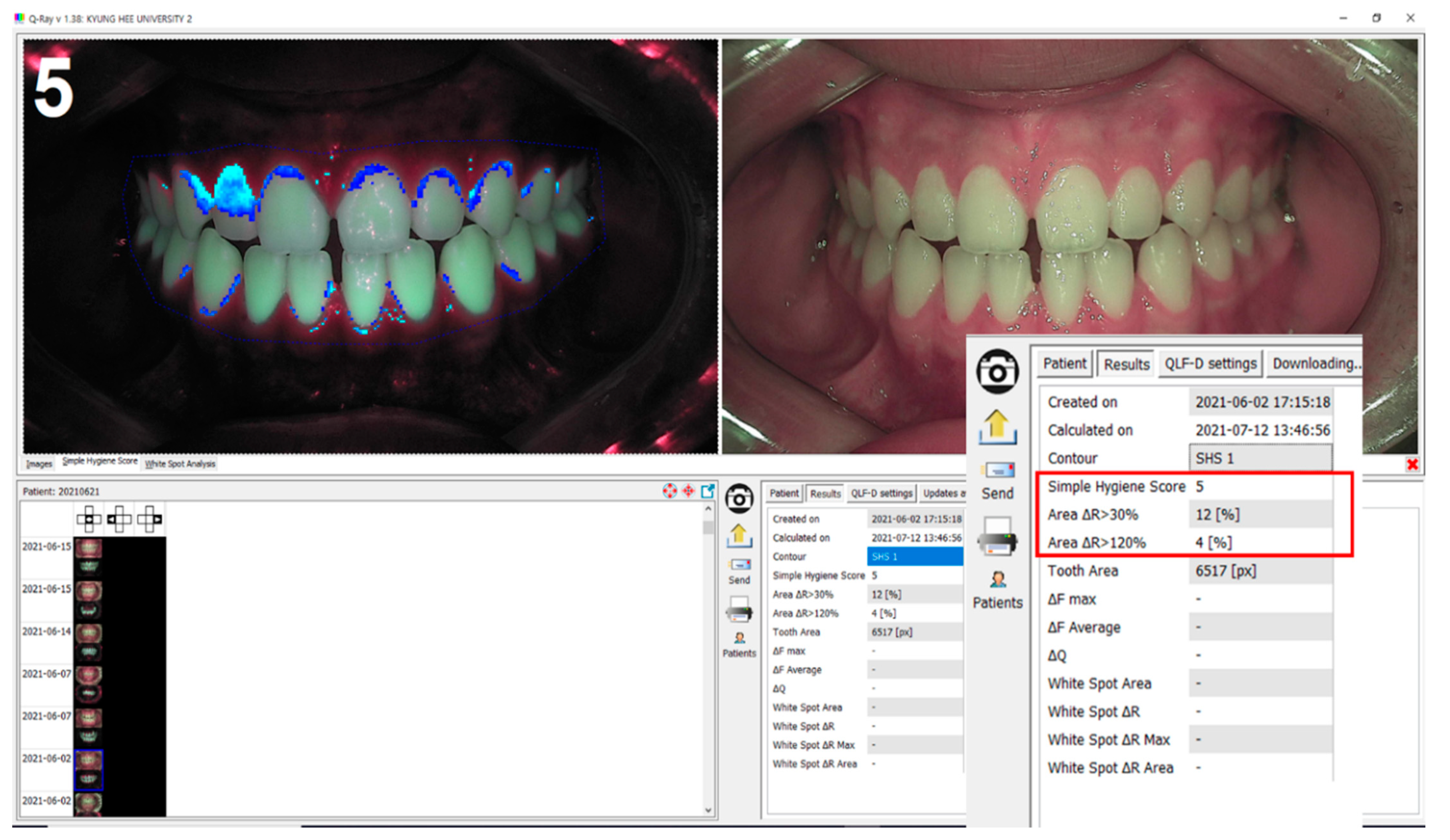 Sensors 21 05774 g003 550
