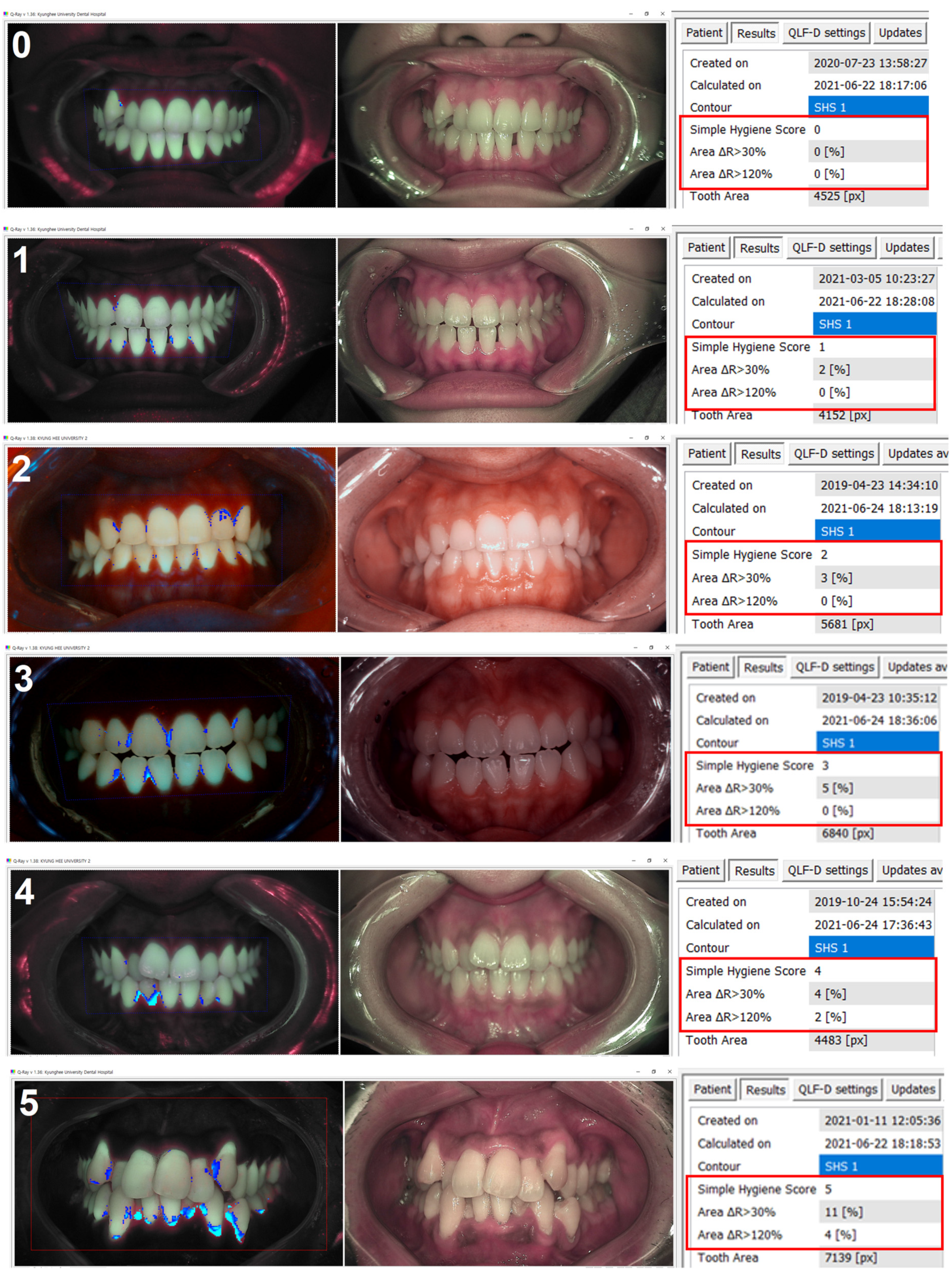 Sensors 21 05774 g004 550