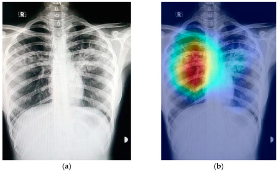 No description has been provided for this image