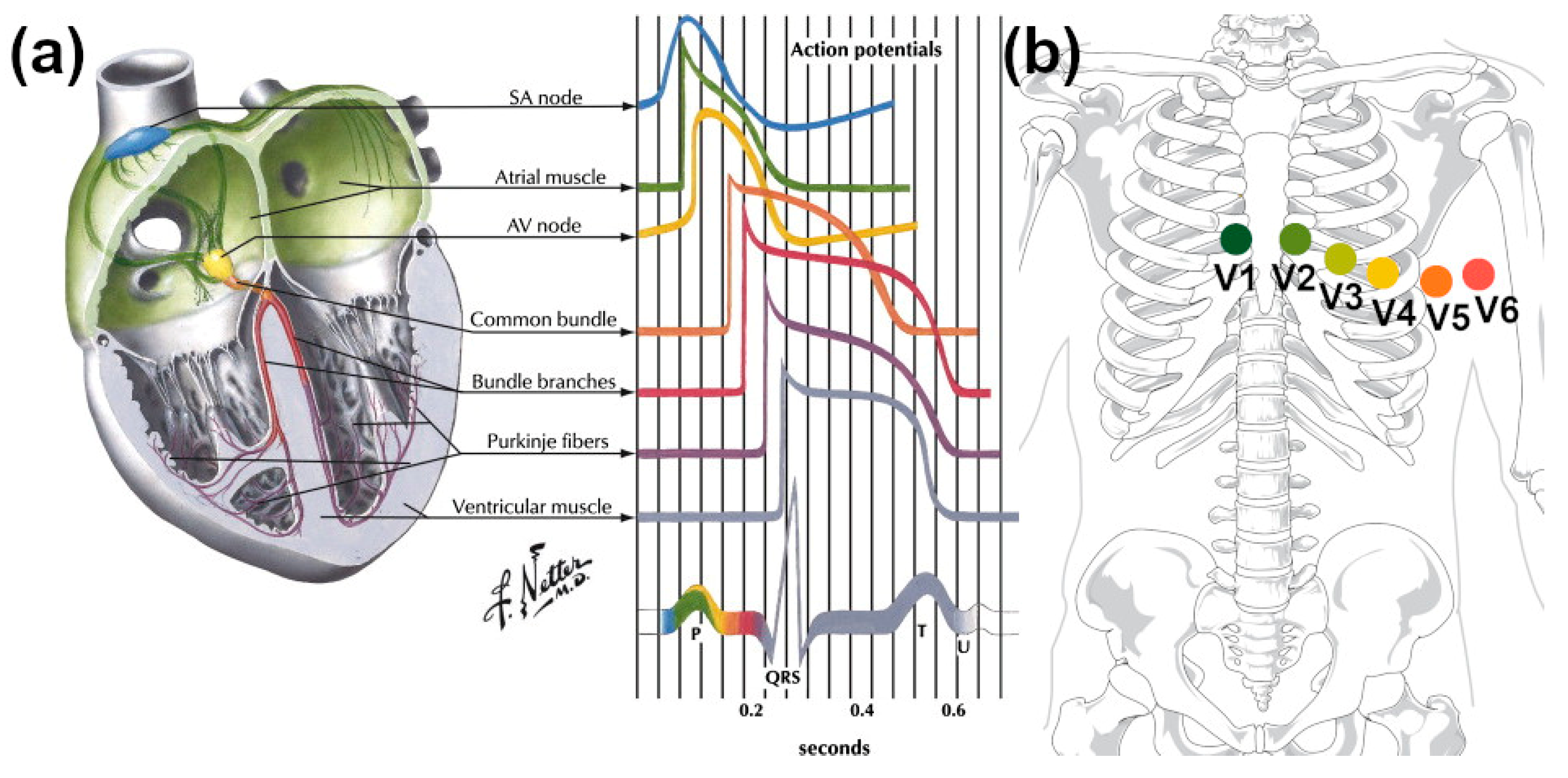 Sensors 21 05847 g008 550