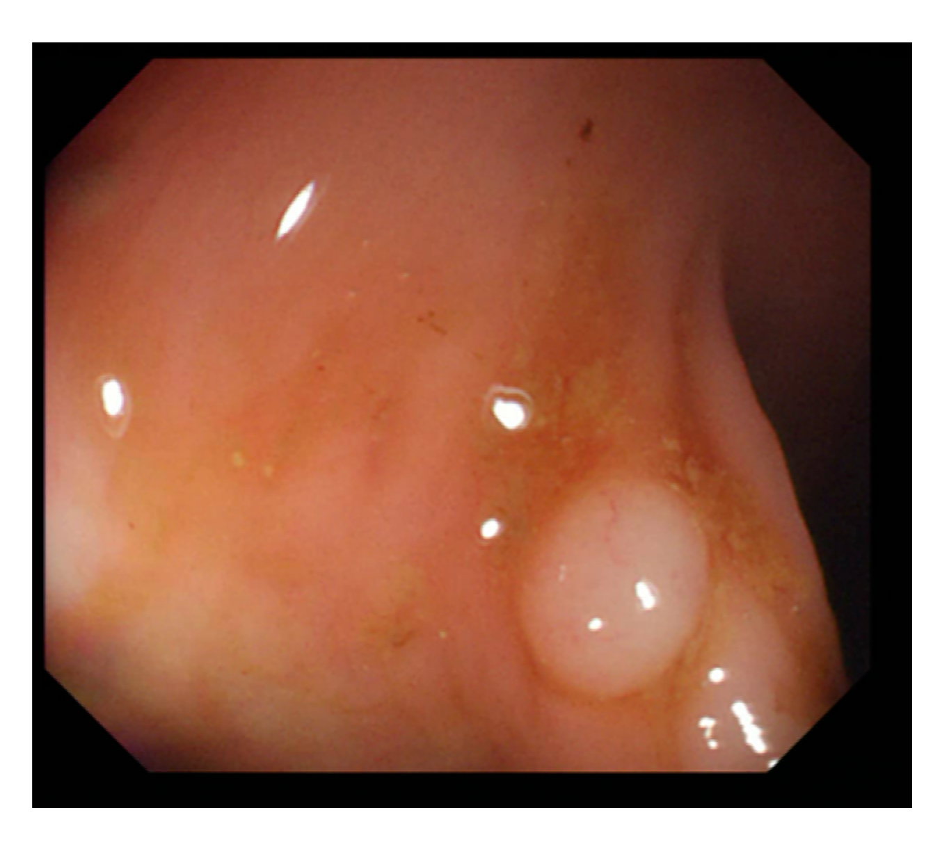 Sensors 21 05995 g004