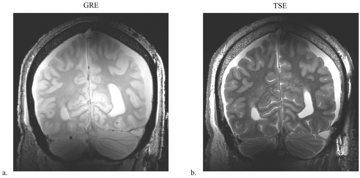 Sensors 21 06000 g006