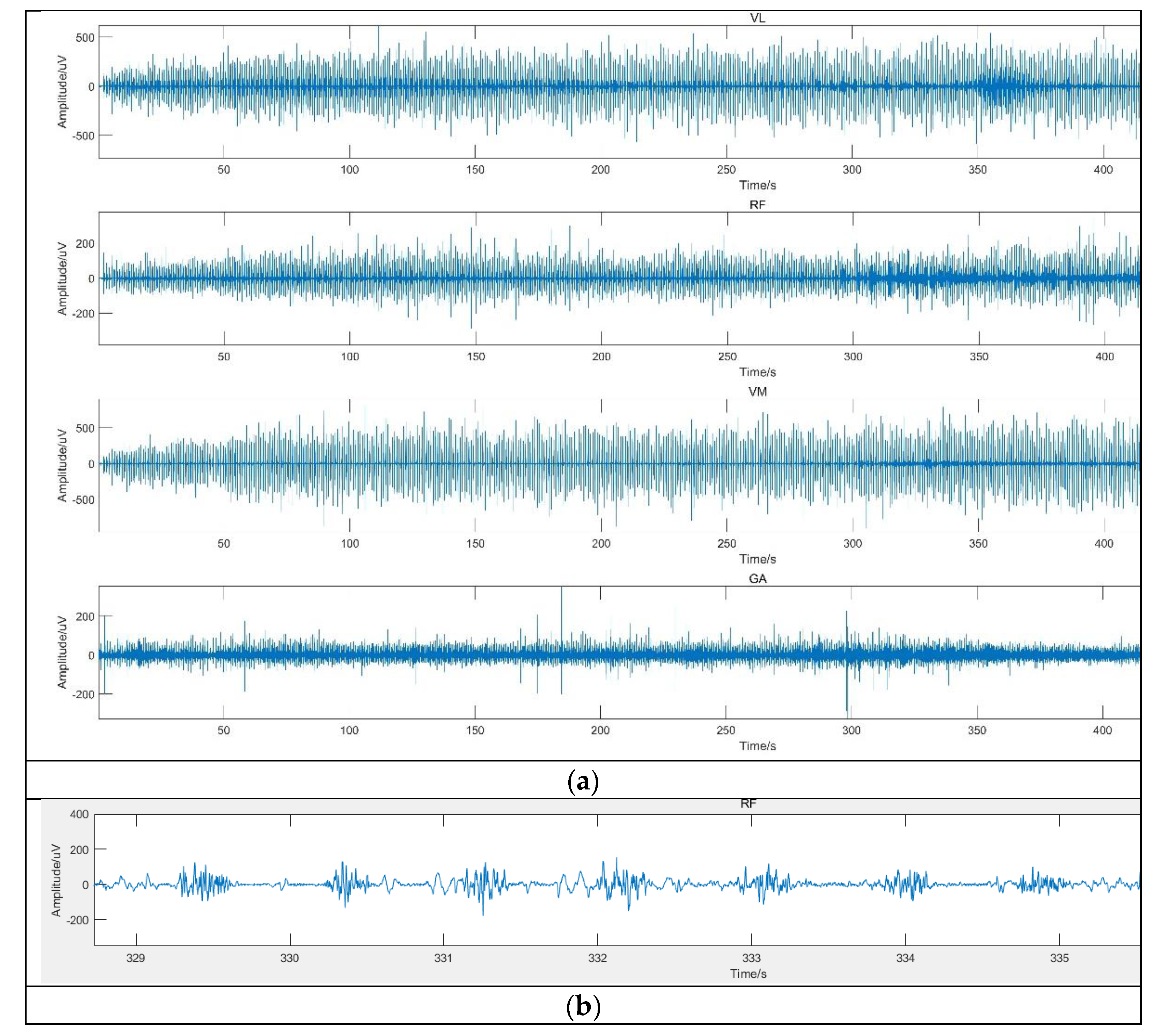 Sensors 21 06369 g008 550