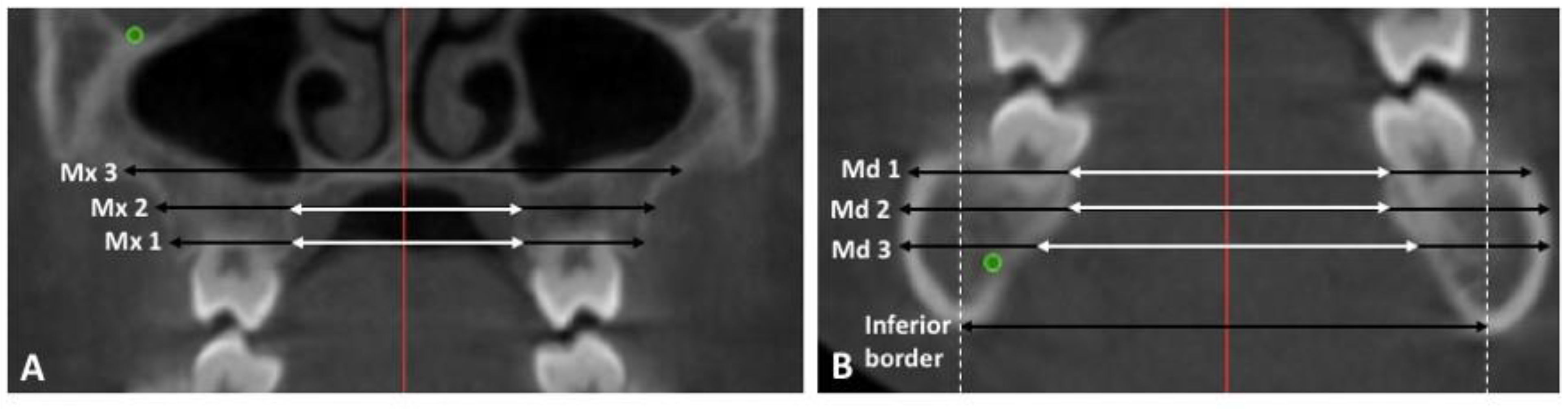 Sensors 21 06378 g003 Sensors 21 06378 g003