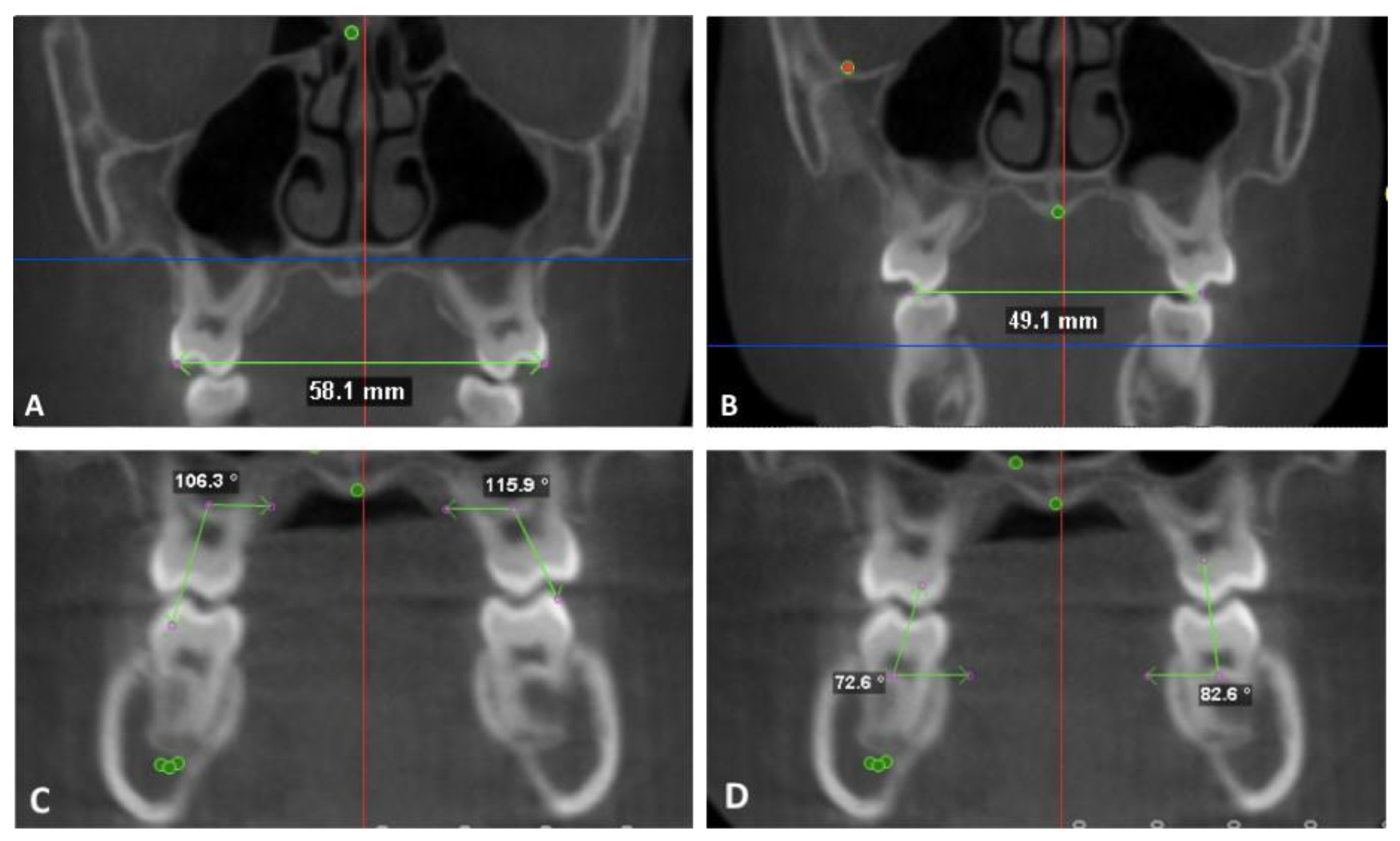 Sensors 21 06378 g004 Sensors 21 06378 g004