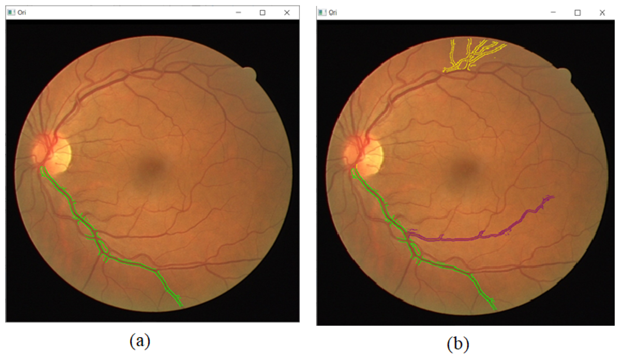 Sensors 21 06380 g006