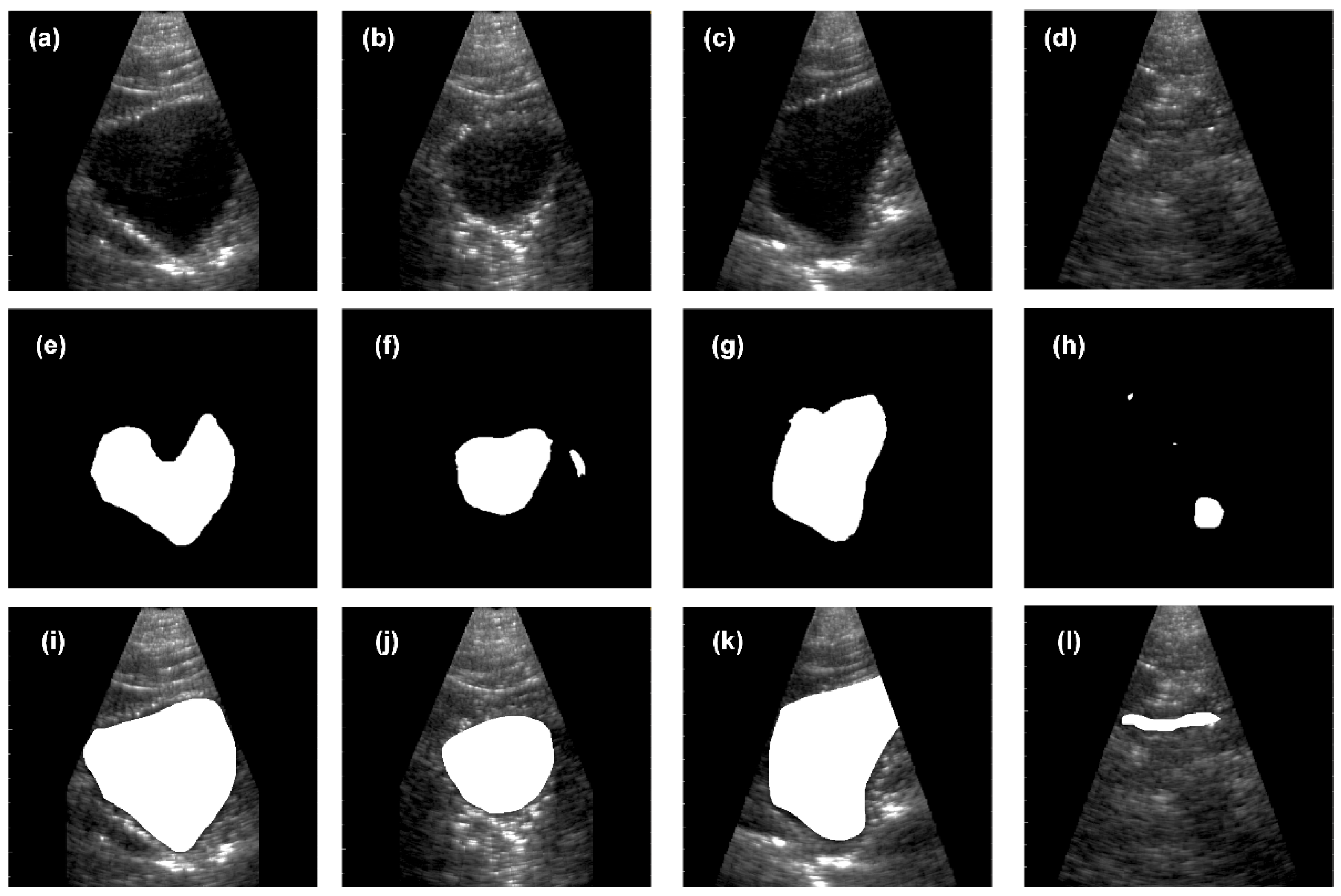 Sensors Free FullText Portable Ultrasound Research System for Use