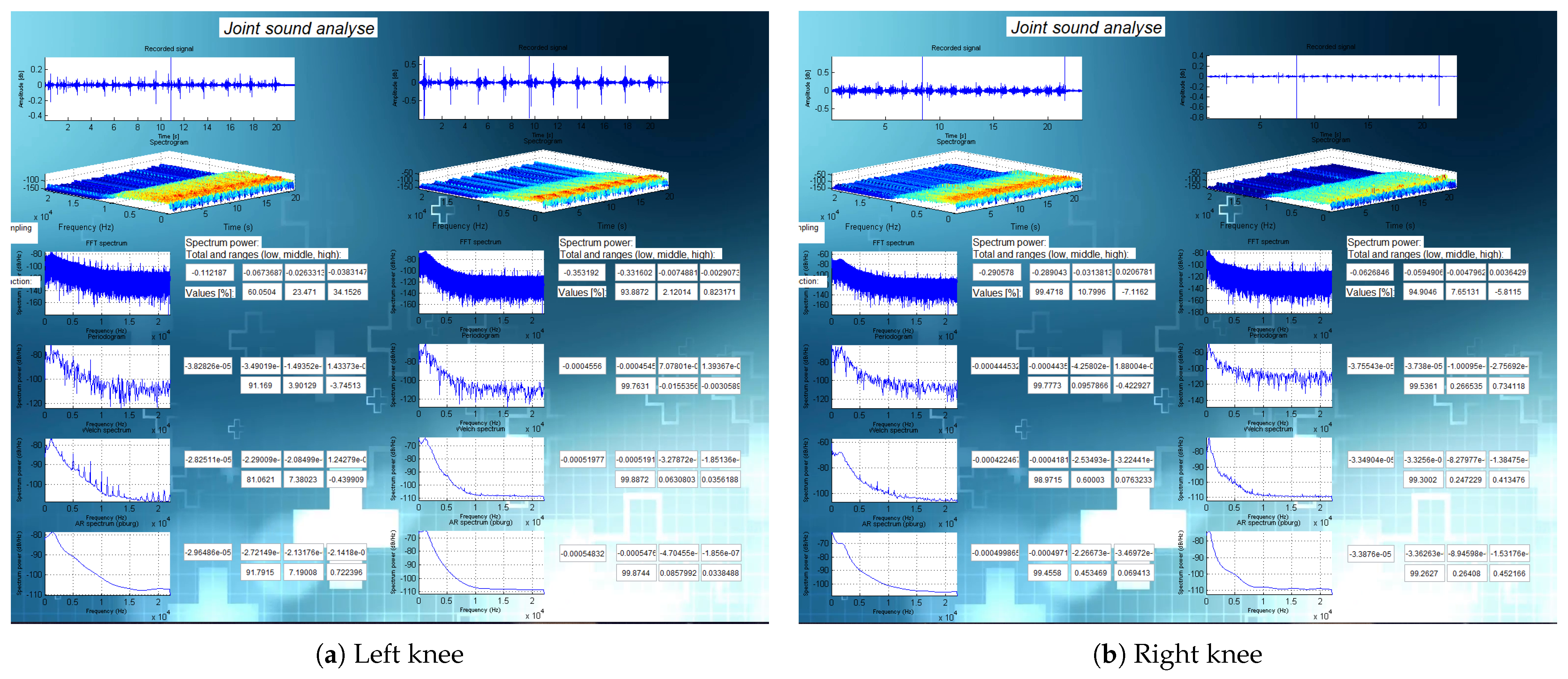 Sensors 21 06495 g0a9