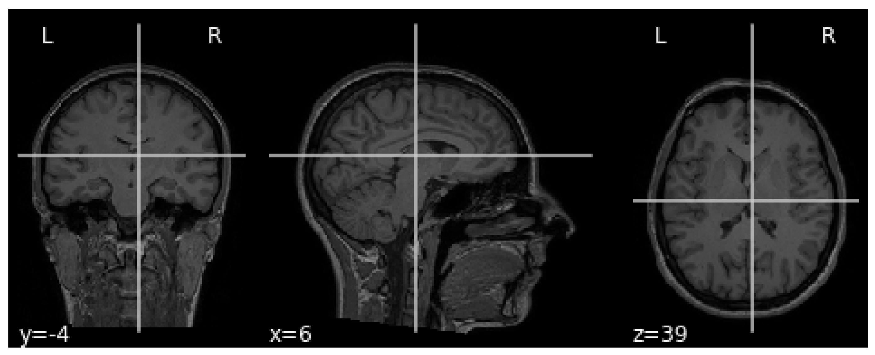 Sensors 21 06654 g003 550