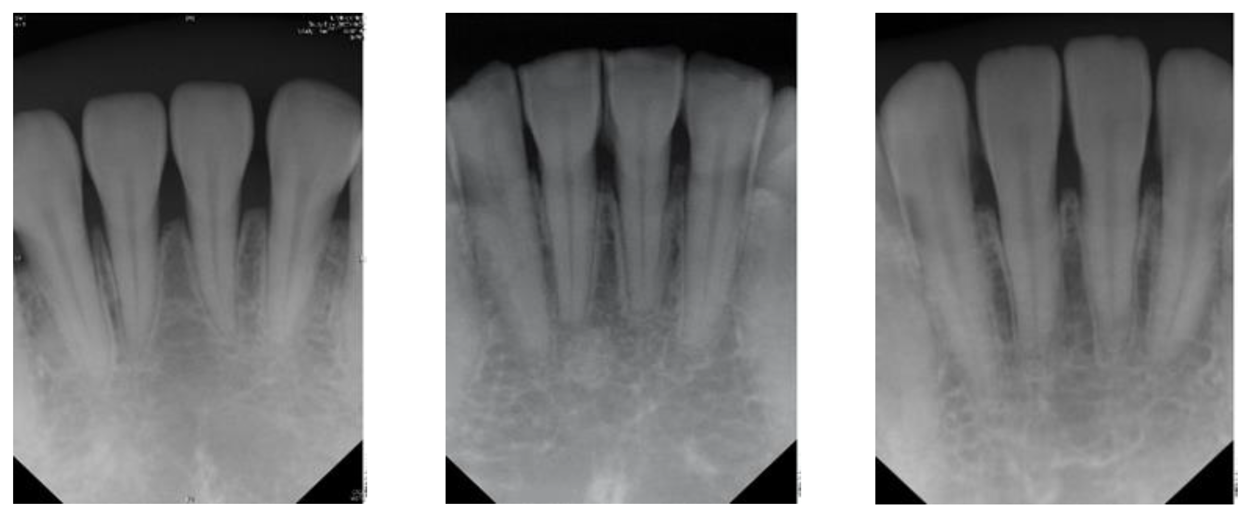 sensors free full text detection of dental apical lesions using cnns on periapical radiograph html