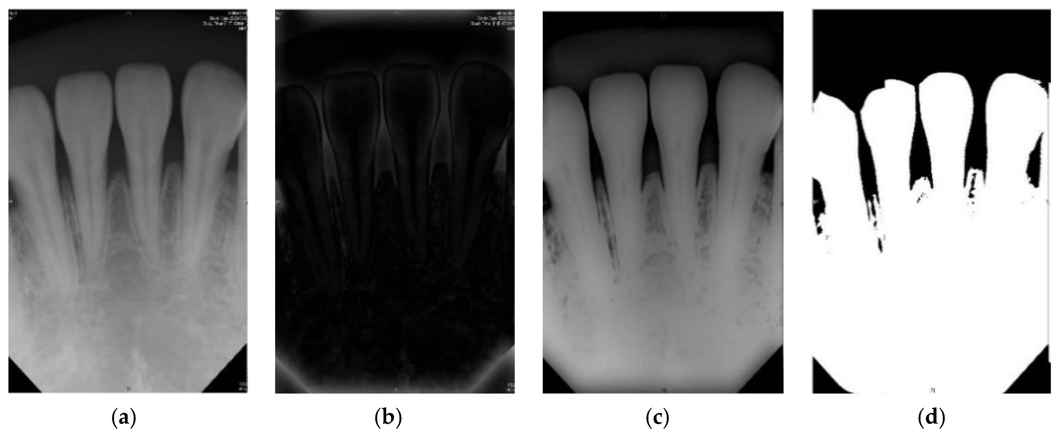 sensors free full text detection of dental apical lesions using cnns on periapical radiograph html