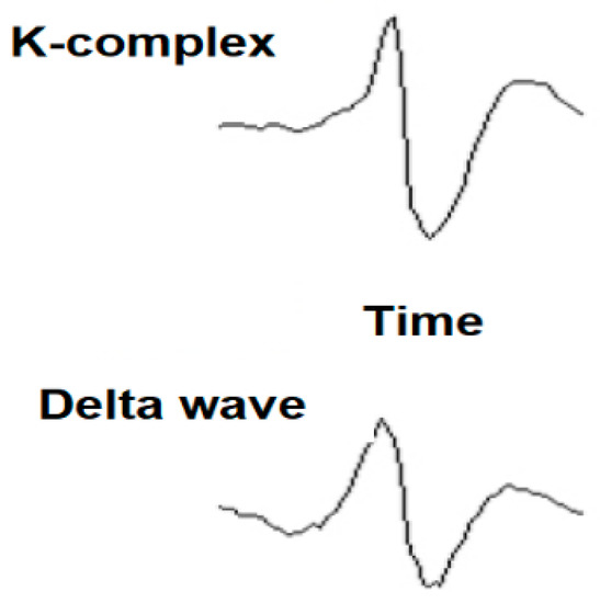 Sensors Free FullText Automatic Detection of Using the