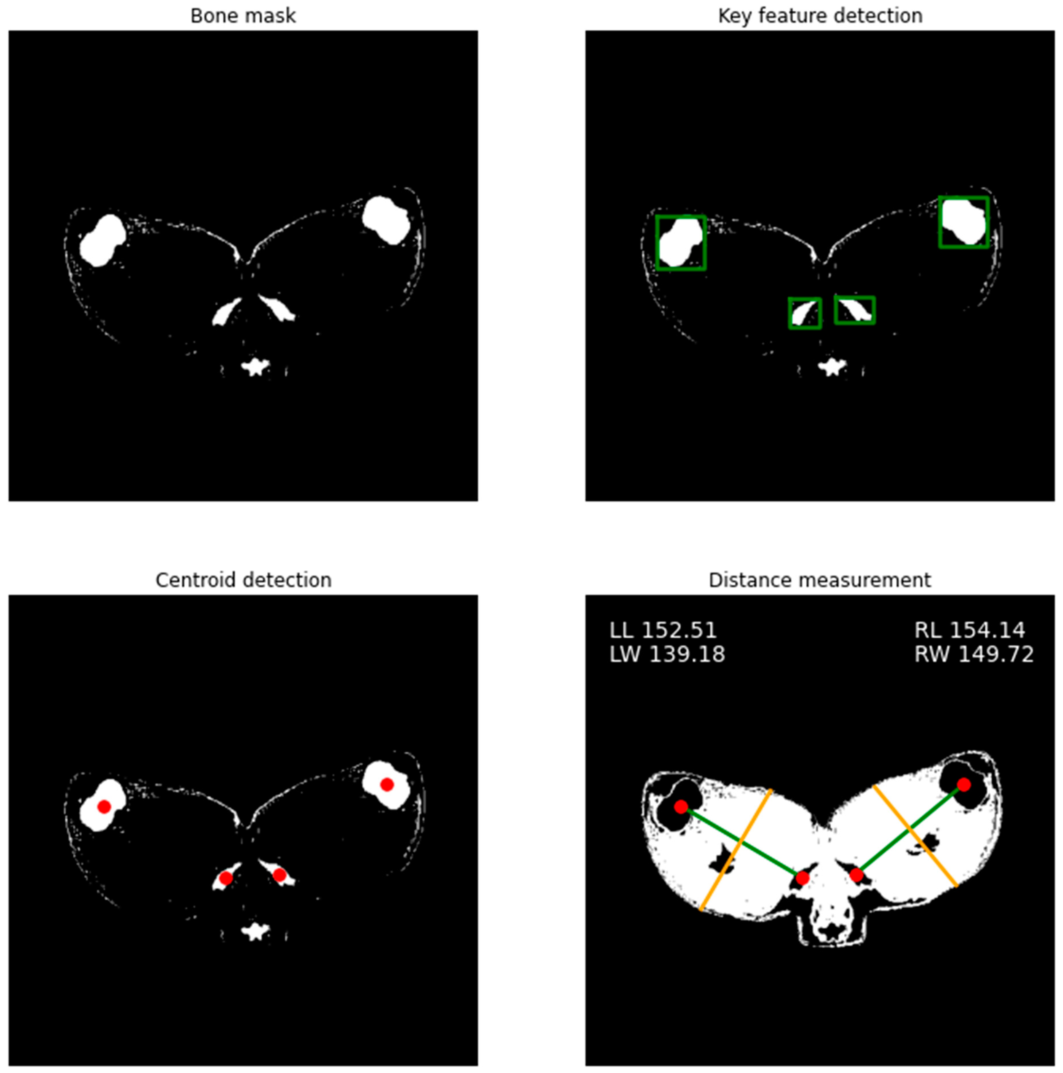 Sensors 21 07268 g007 550