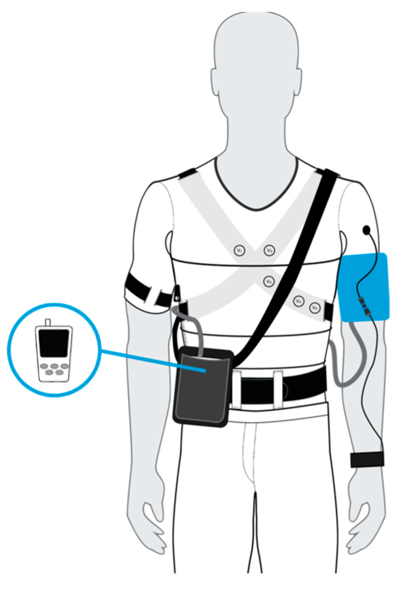 Gima - Intelligent Automatic Digital Arm Blood Pressure Monitor for