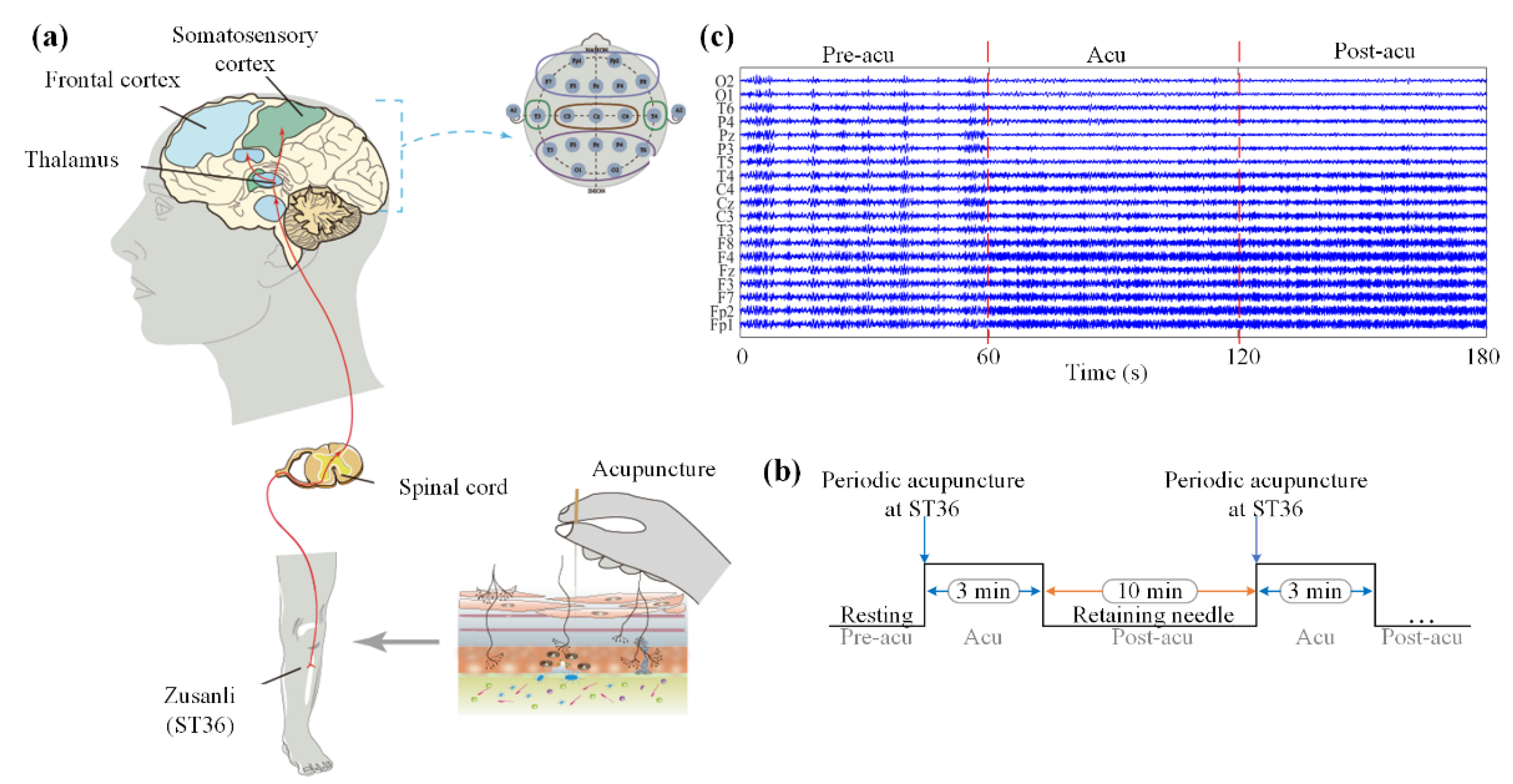 Sensors 21 07432 g001 550