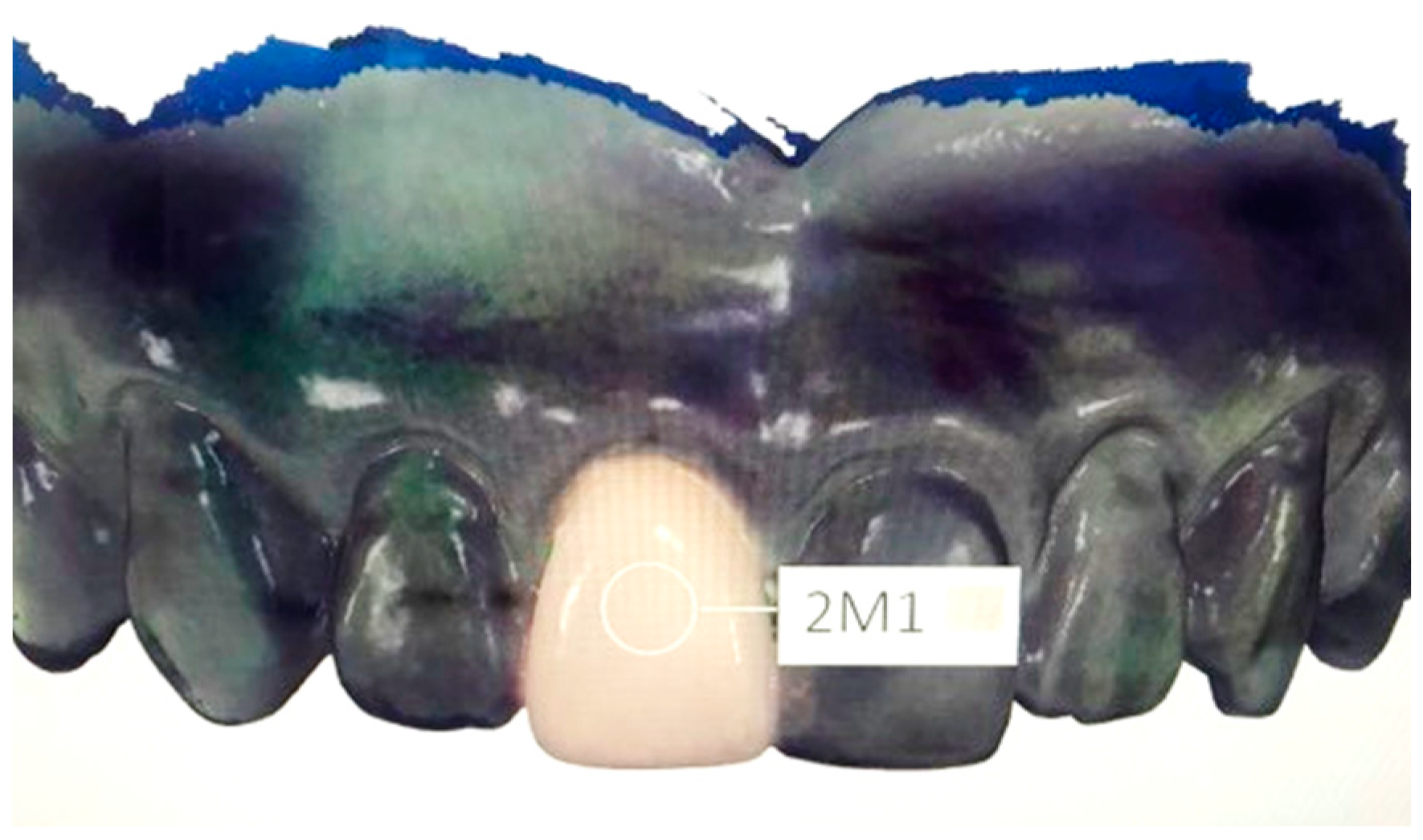 Sensors 21 07490 g006