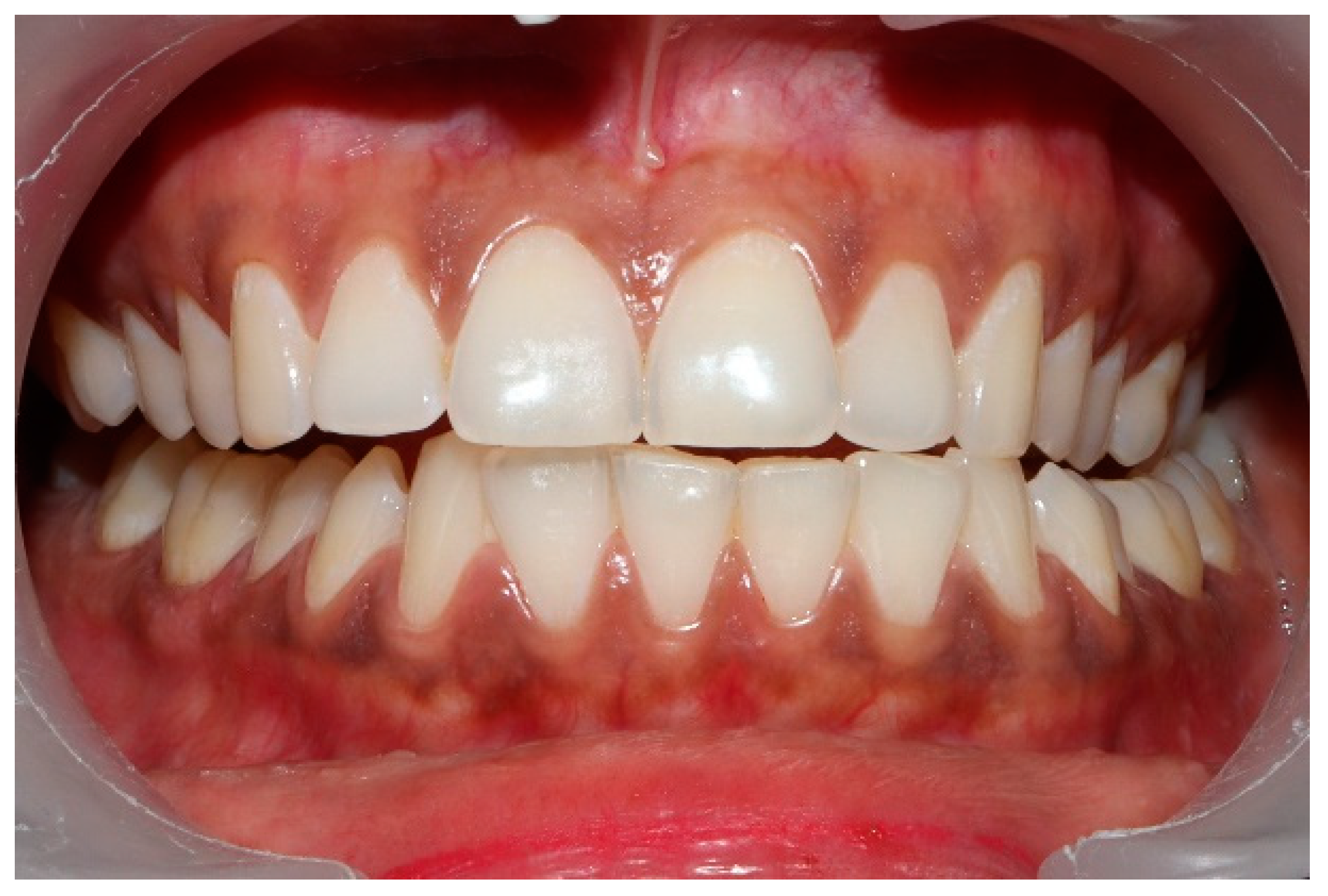 Sensors 21 07804 g008 550