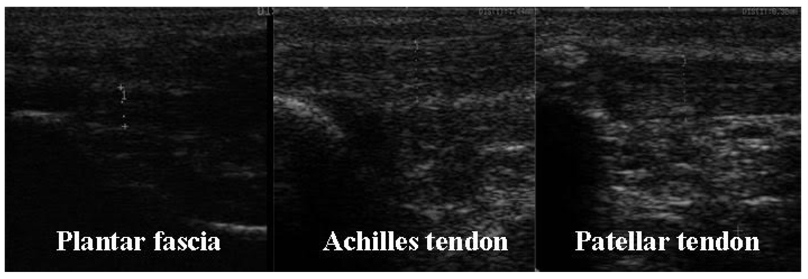 Sensors 21 07814 g004