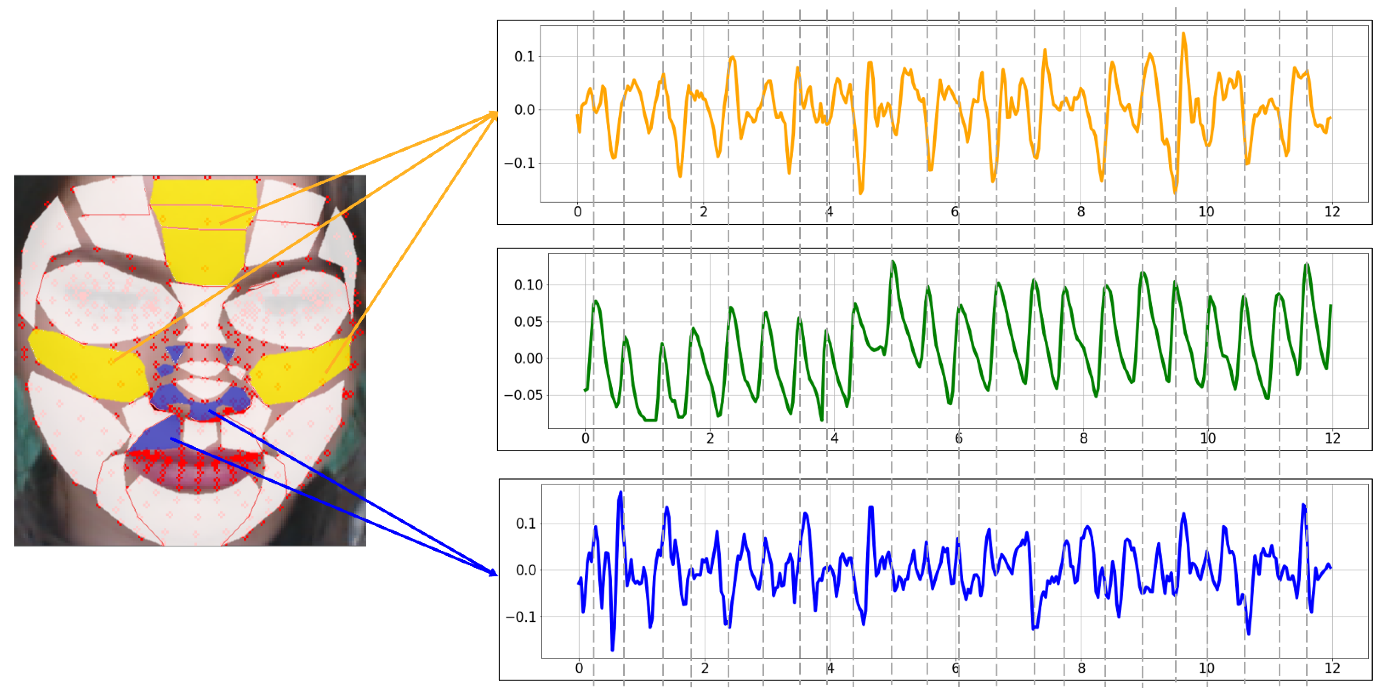 Sensors 21 07923 g011 550
