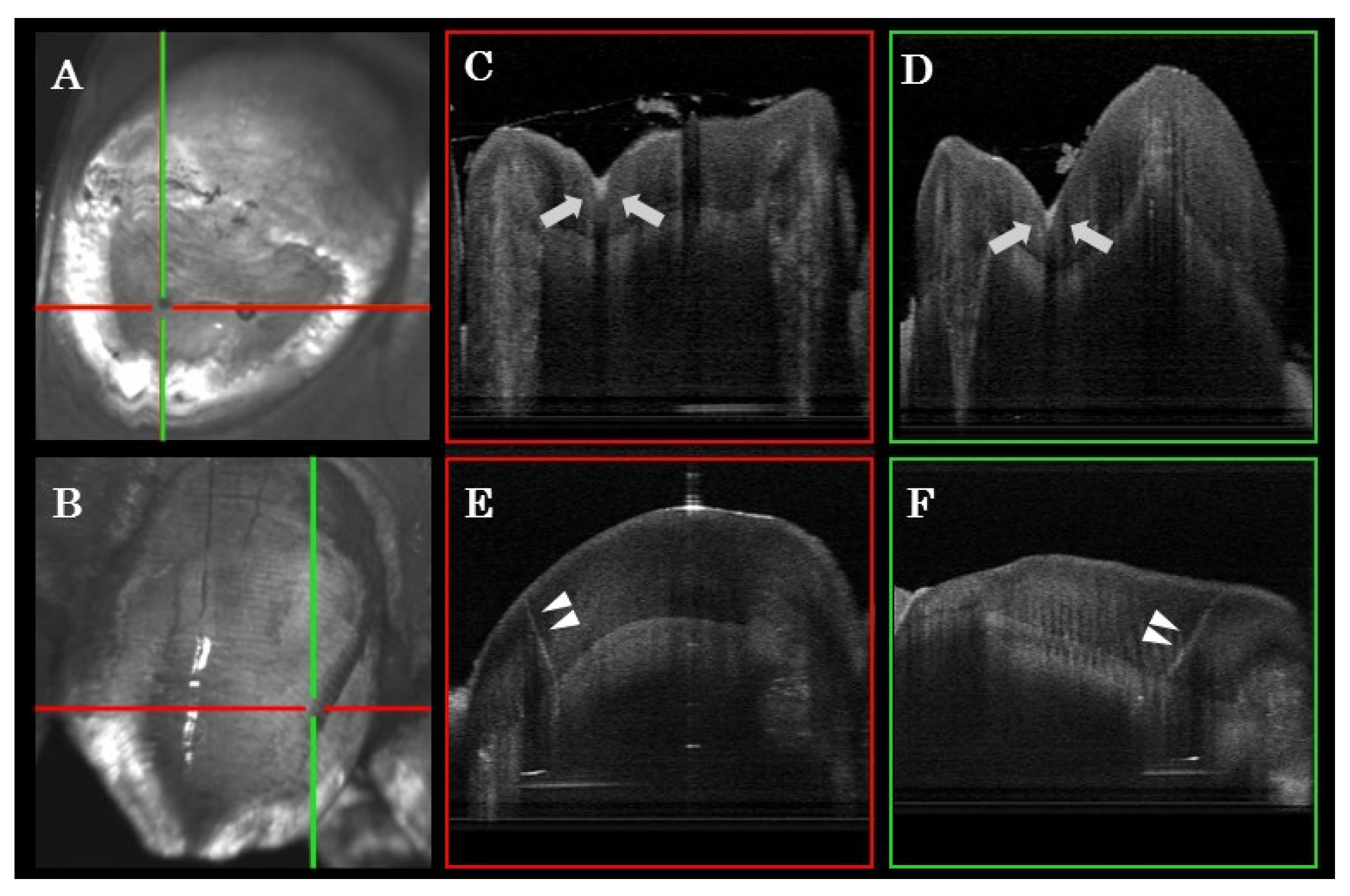 Sensors 21 07940 g005