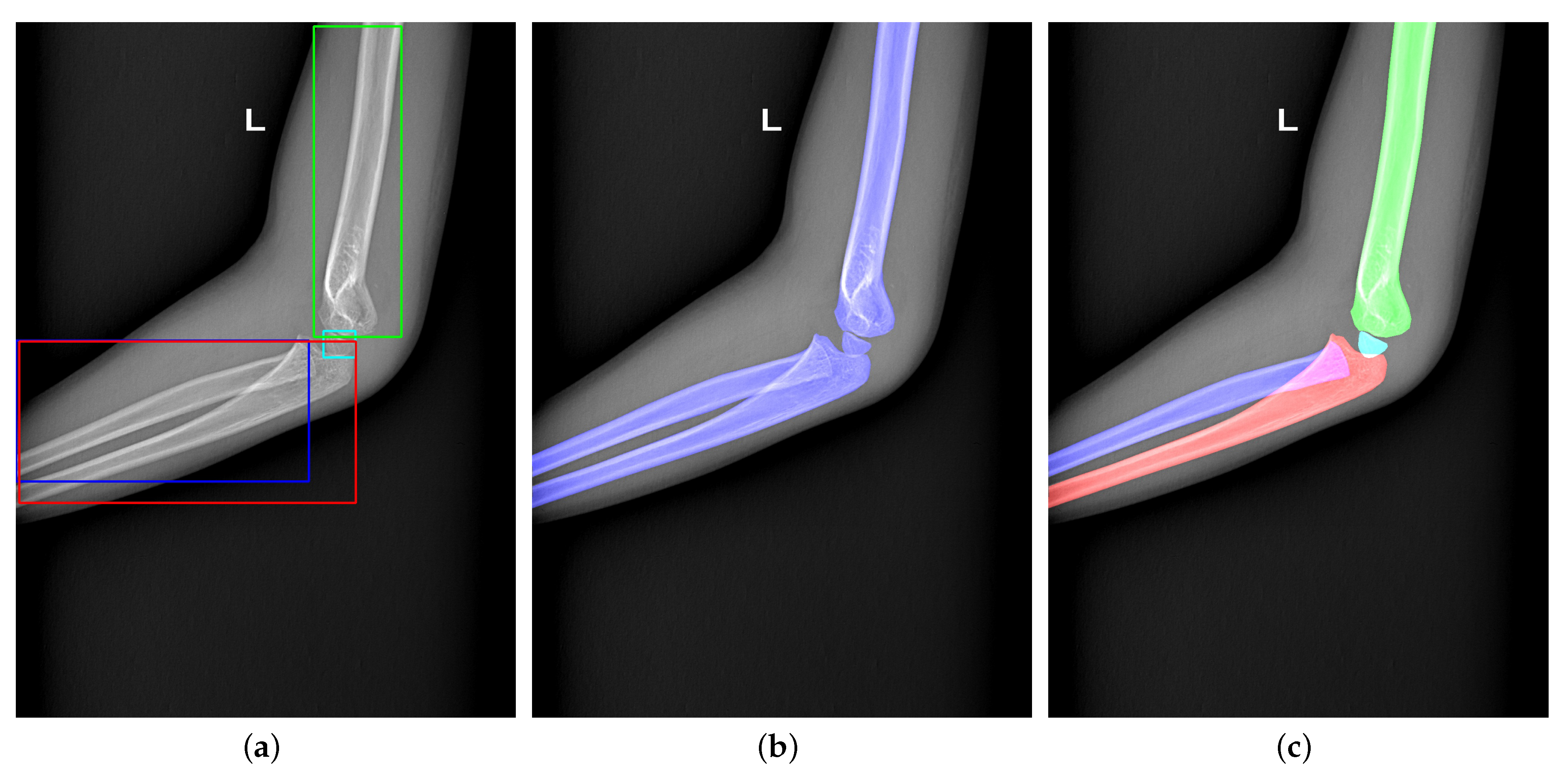 Sensors 21 07966 g002 550