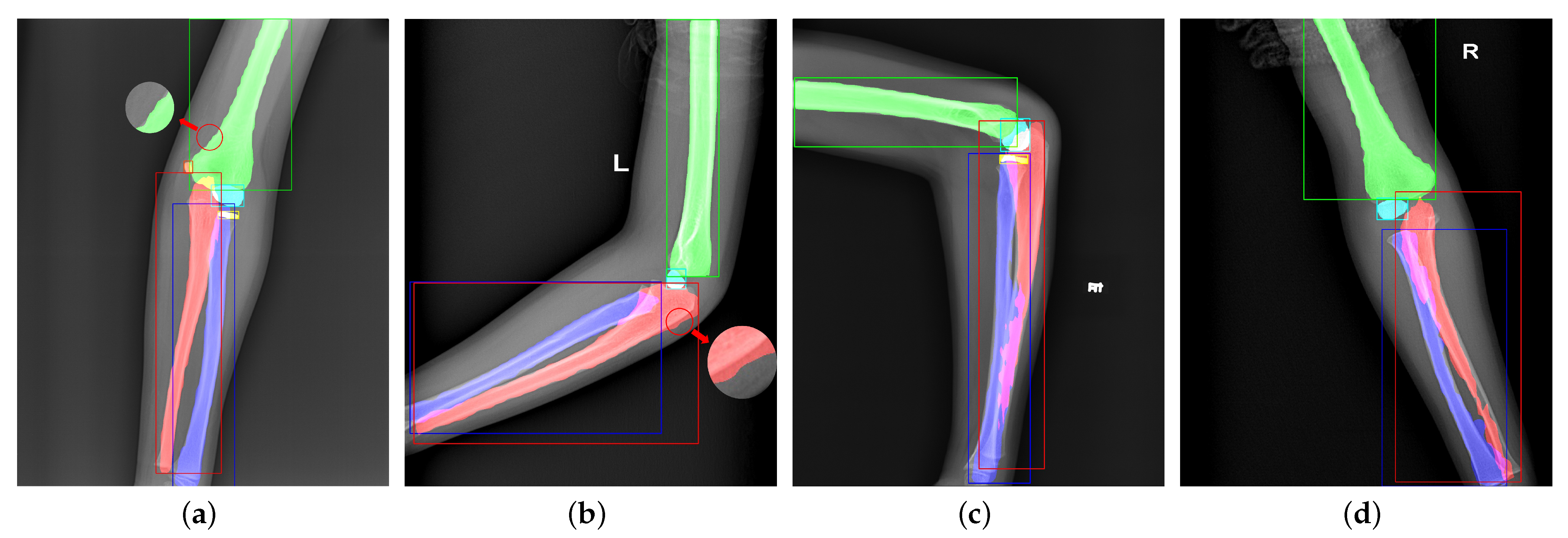 Sensors 21 07966 g006 550