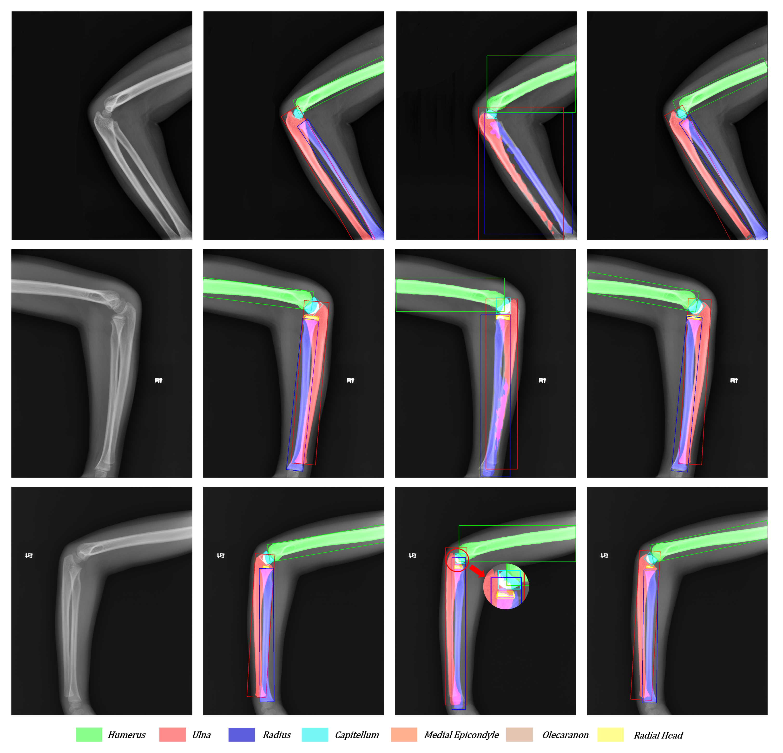 Sensors 21 07966 g011 550