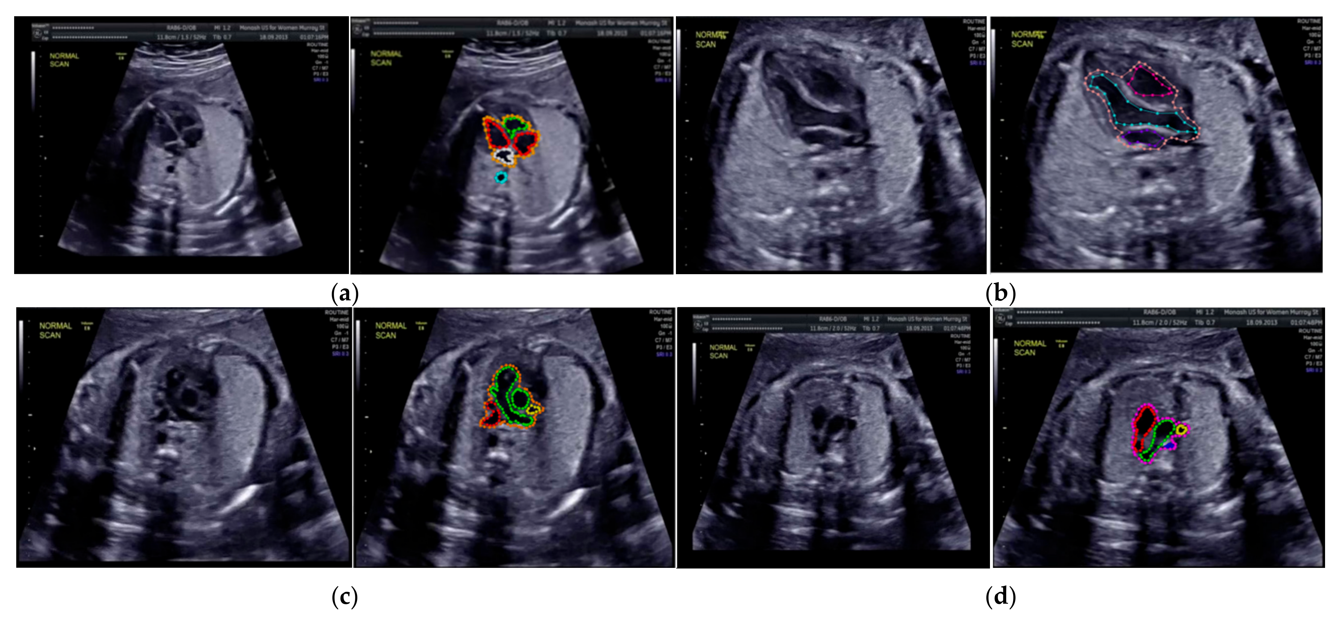 Sensors 21 08007 g004 550