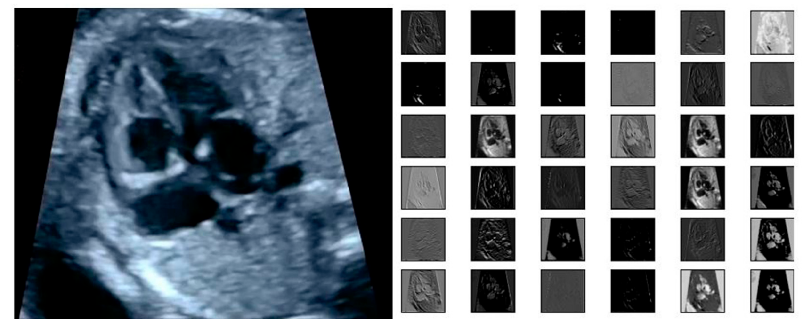 Sensors 21 08007 g007 550